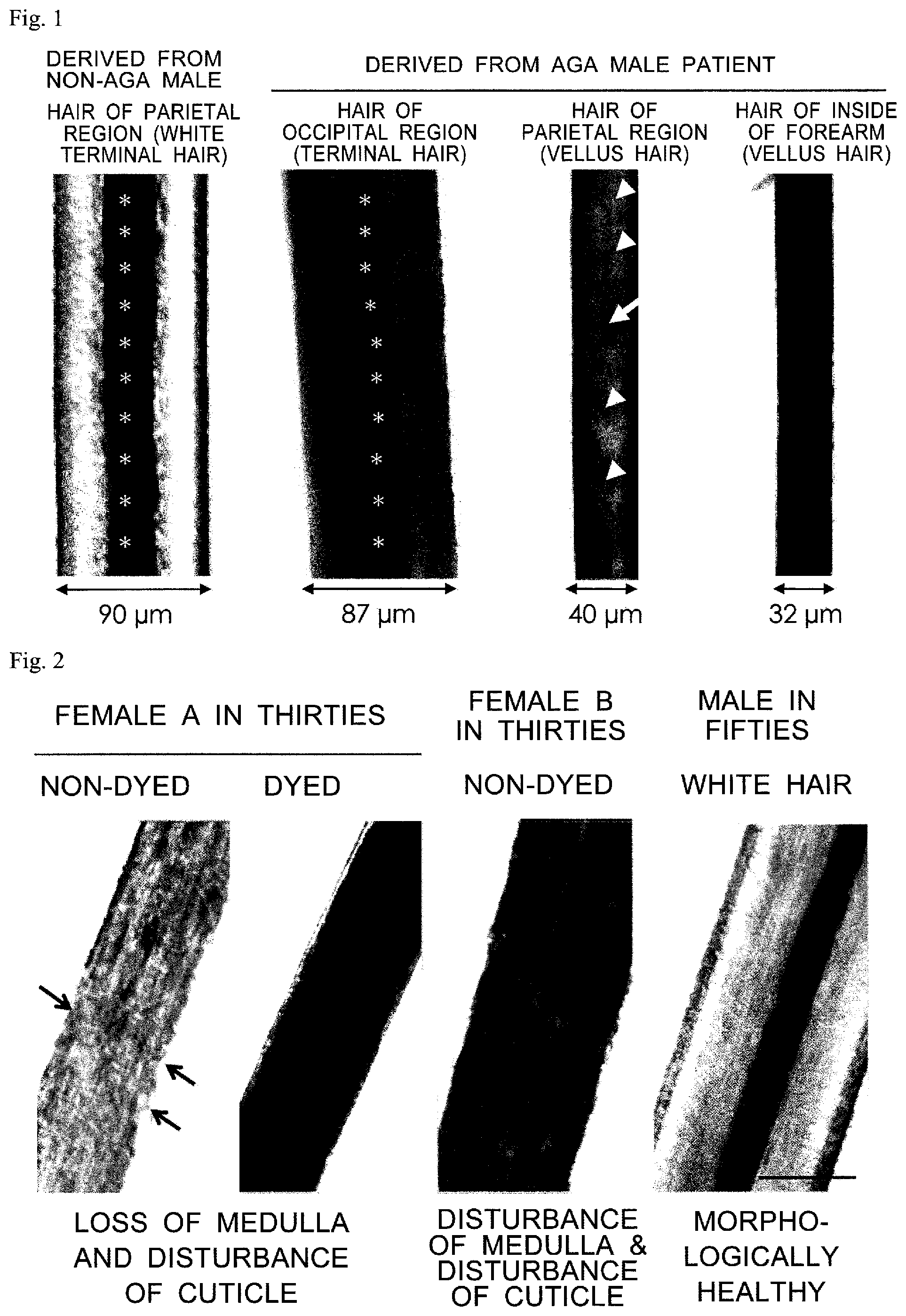 Patent US12326438 — Health-level measuring method, health-level determining apparatus, and hair-health examination system — Figure 1