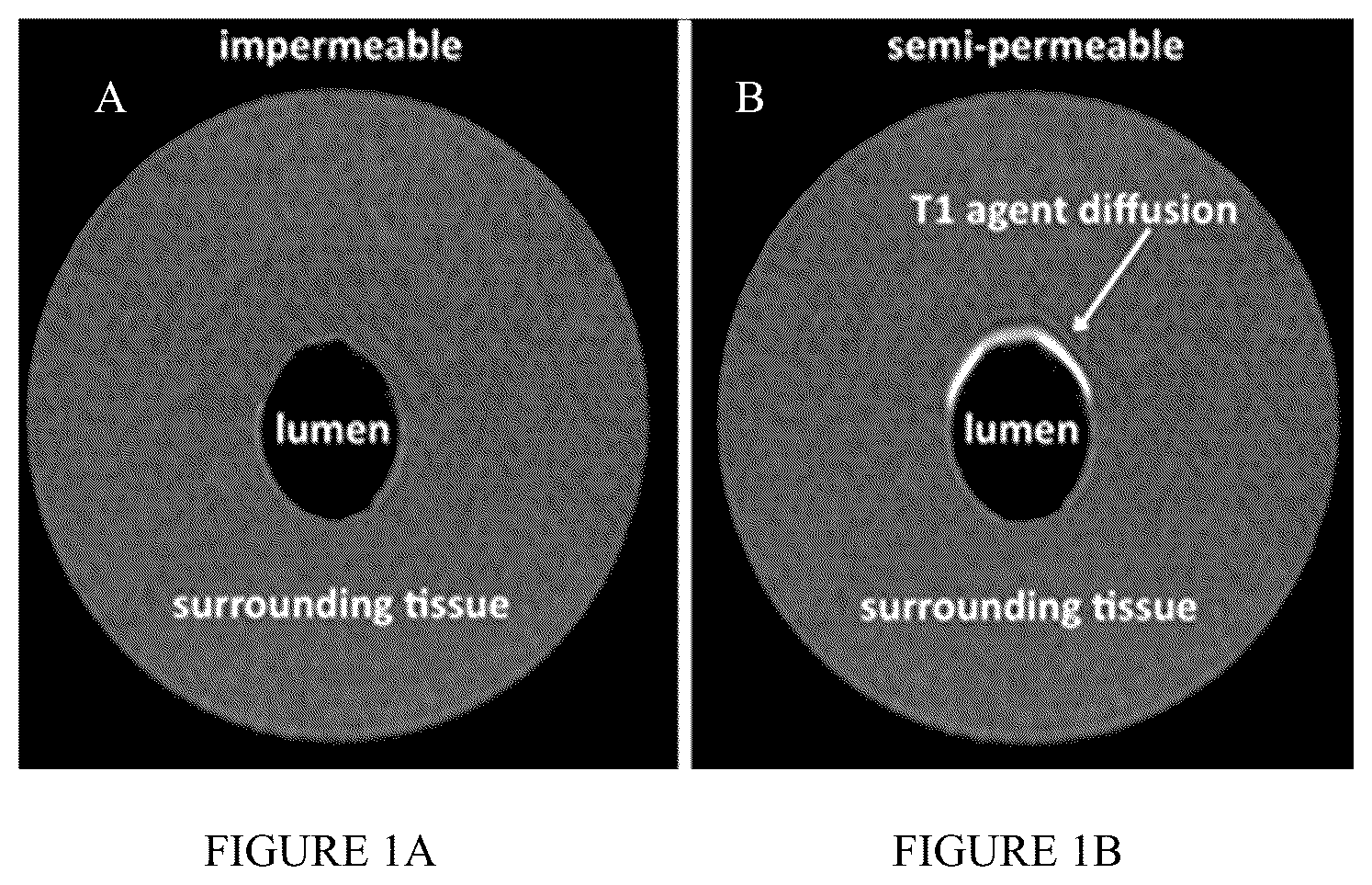 Patent US12326492 — Systems and methods of detecting interstitial cystitis — Figure 1