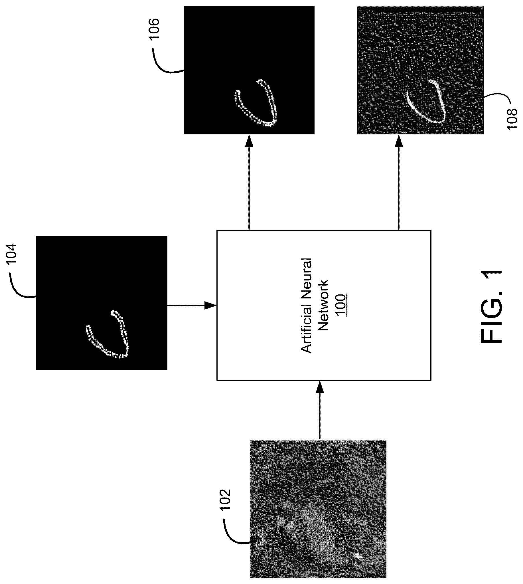 Patent US12327359 — Image segmentation and tracking based on statistical shape model — Figure 1