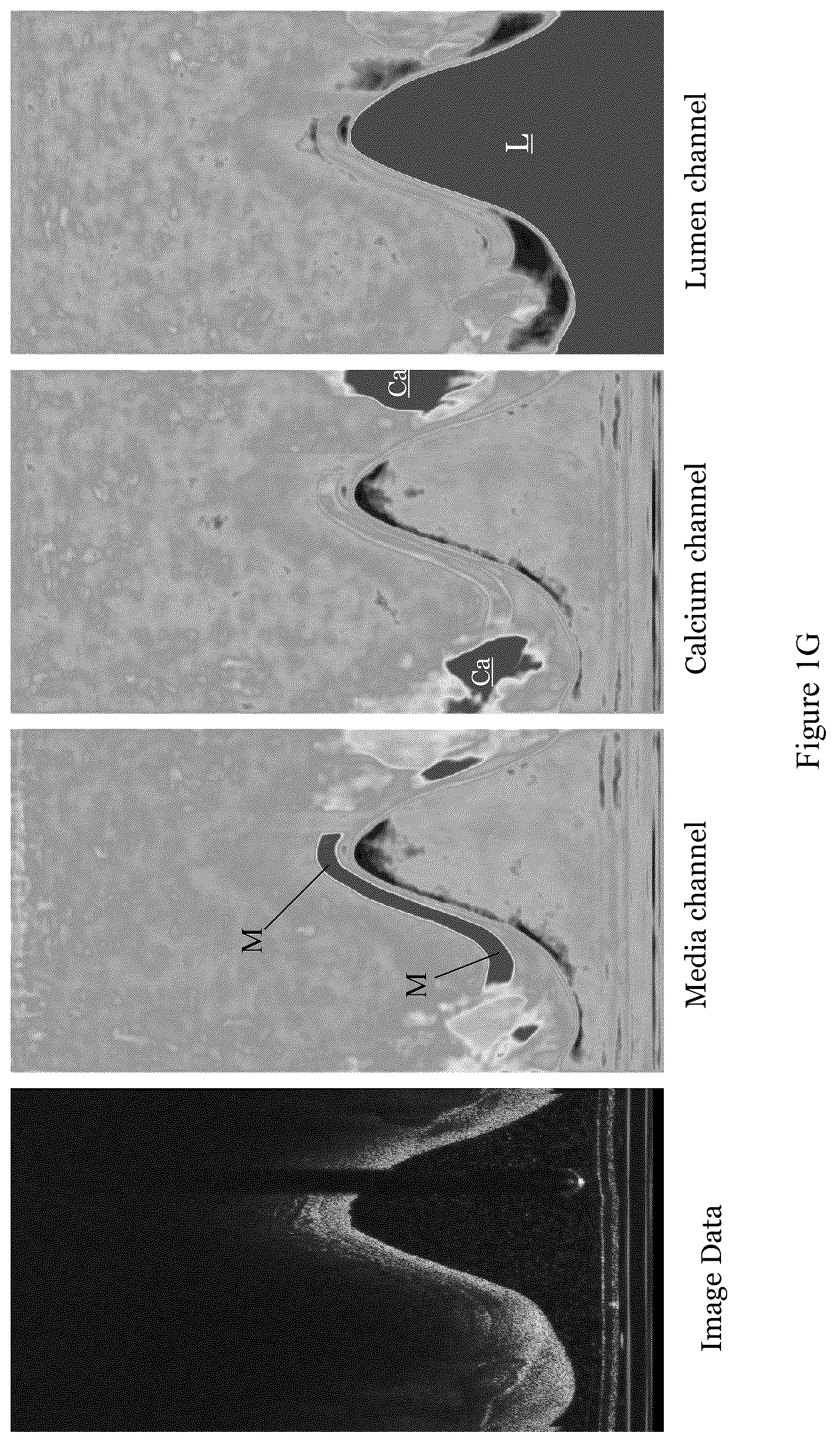 Patent US12327360 Figure 6 – Systems and methods for classification of arterial image regions and features thereof