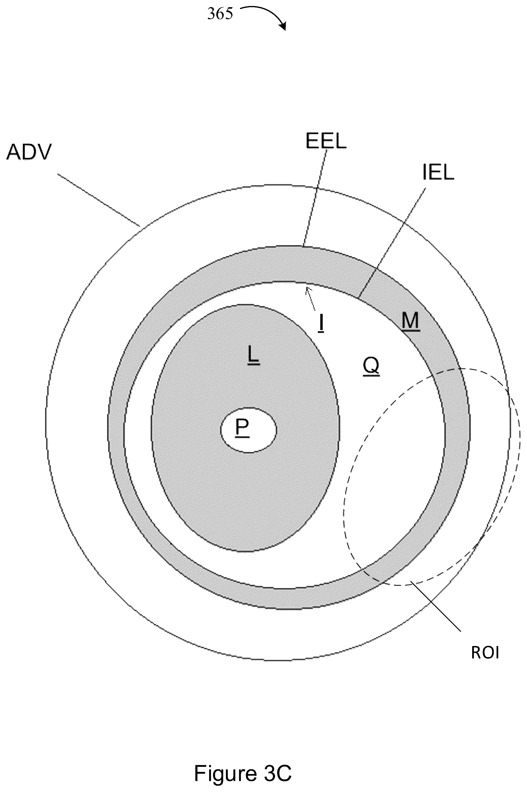 Patent US12327360 Figure 14 – Systems and methods for classification of arterial image regions and features thereof