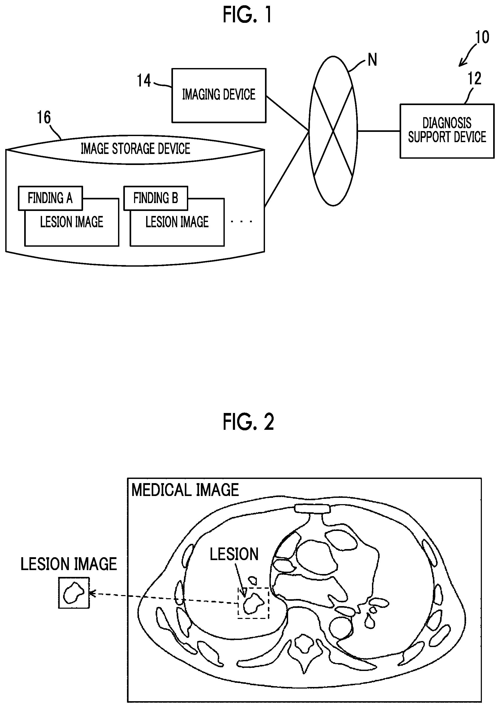 Patent US12327626 — Diagnosis support device, diagnosis support method, and diagnosis support program — Figure 1