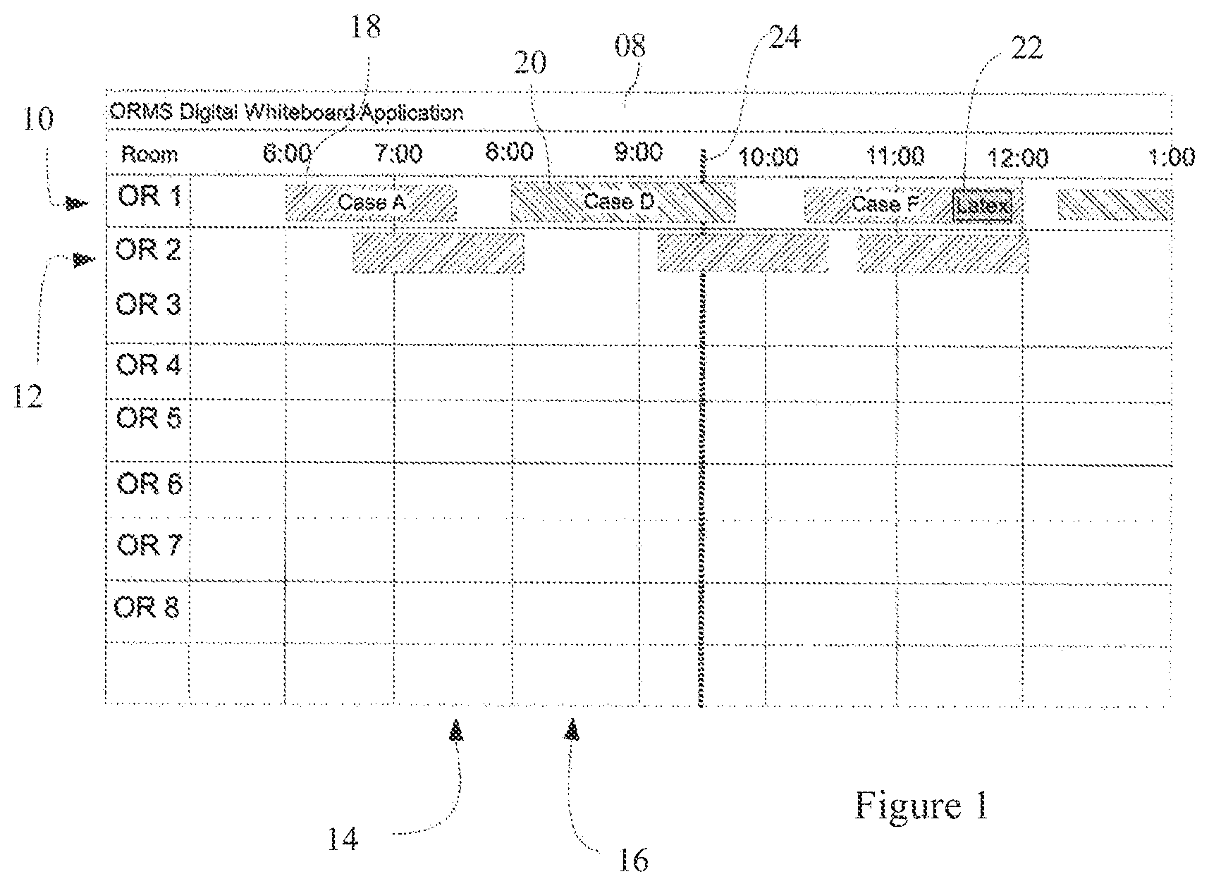Patent US12327634 — Operating room management system with mobile application — Figure 1