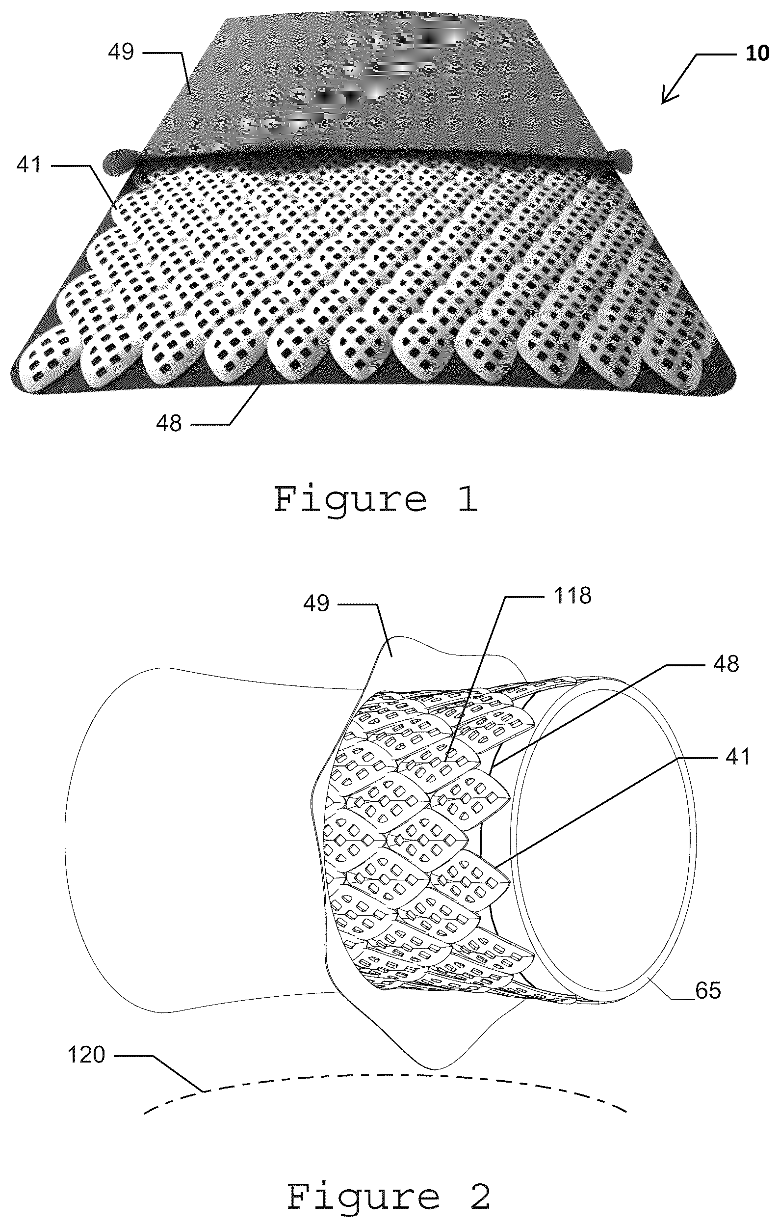 Patent US12332028 Figure 1 – Composite material