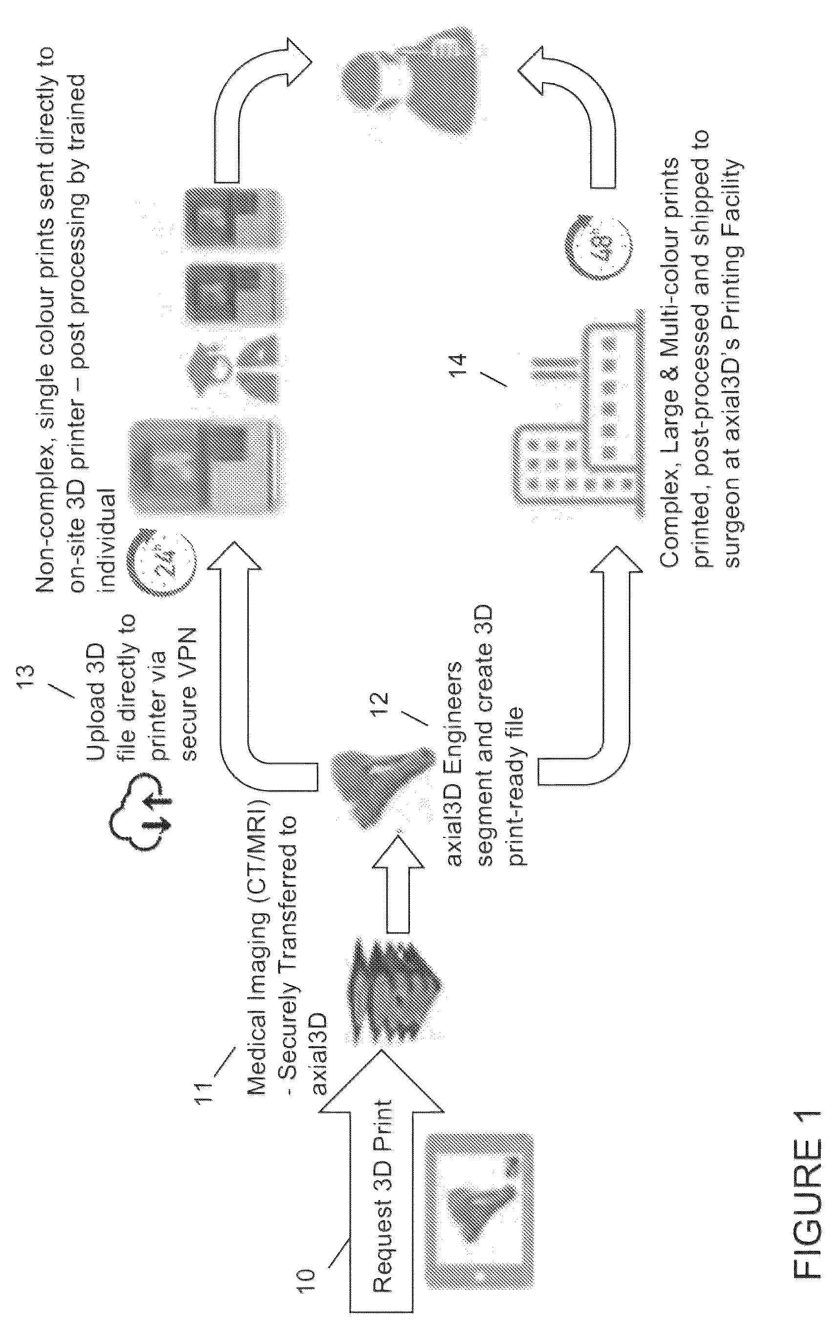 Patent US12333652 Figure 1 – Method for generating a 3D printable model of a patient specific anatomy