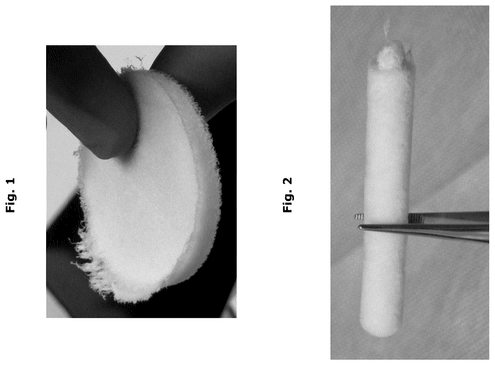 Patent US12338457 — Biologically functional soft tissue scaffolds and implants — Figure 1