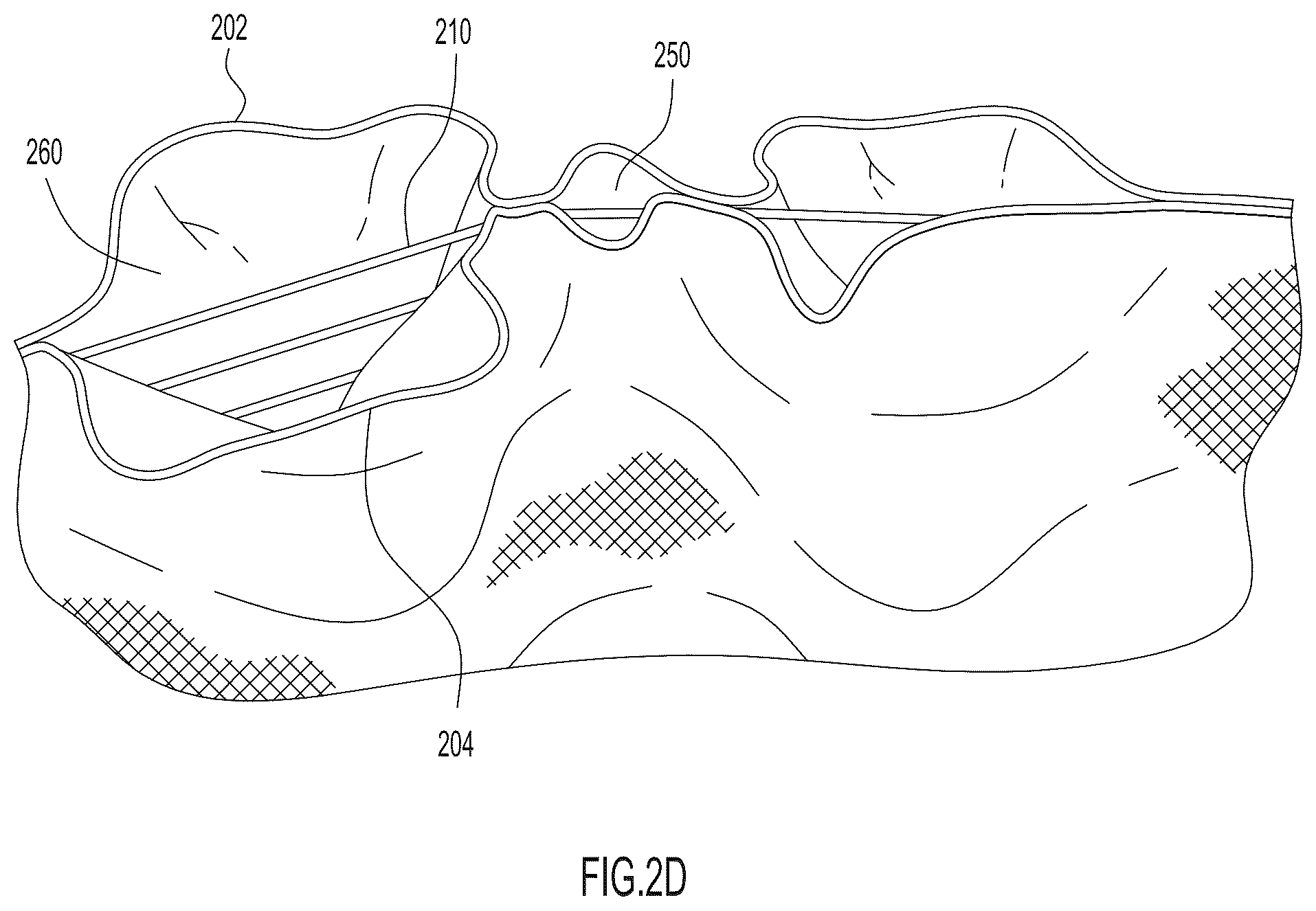 Patent US12338555 Figure 3 – Method of forming an upper for an article of footwear