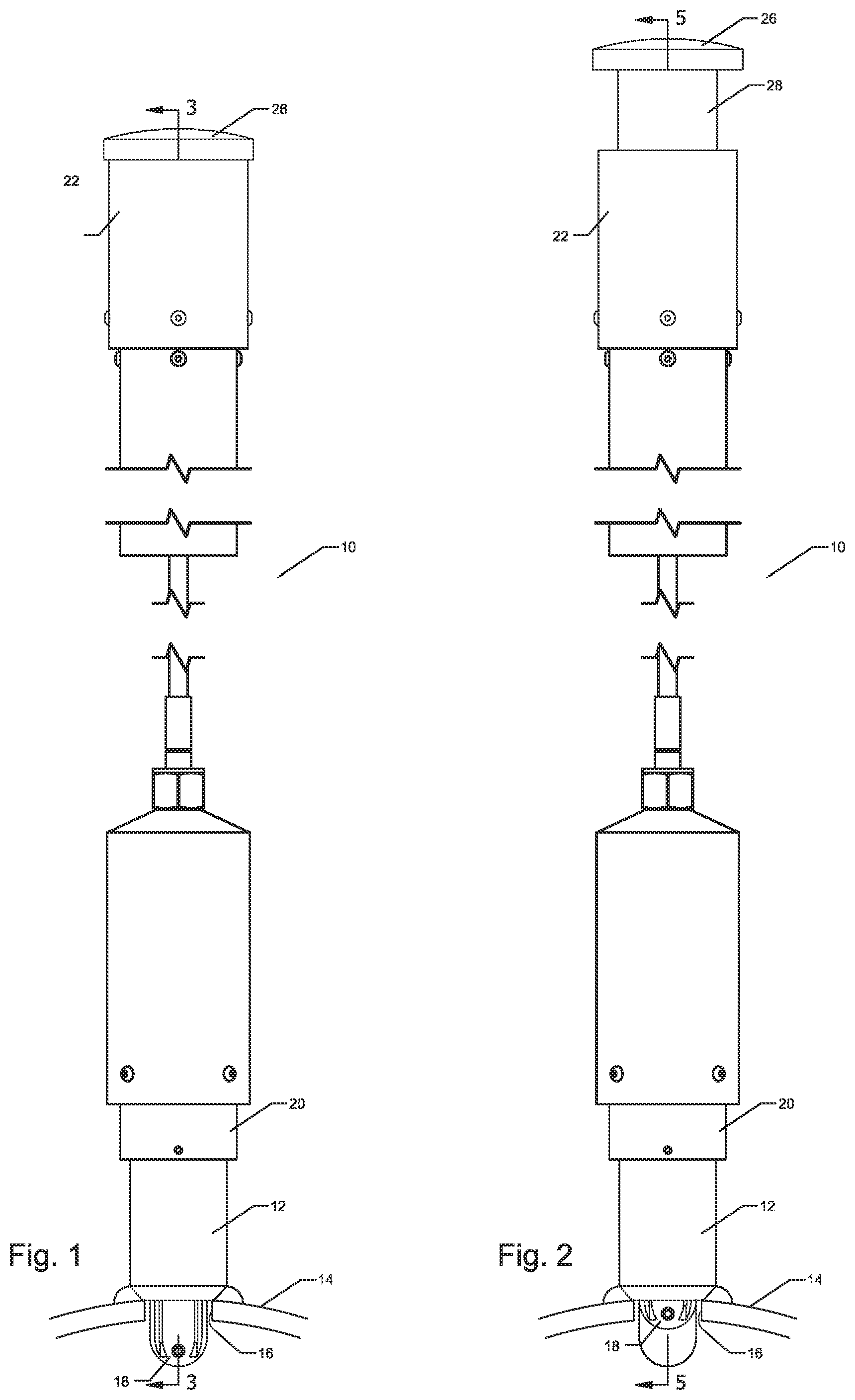 Patent US12338940 — Pig detector — Figure 1