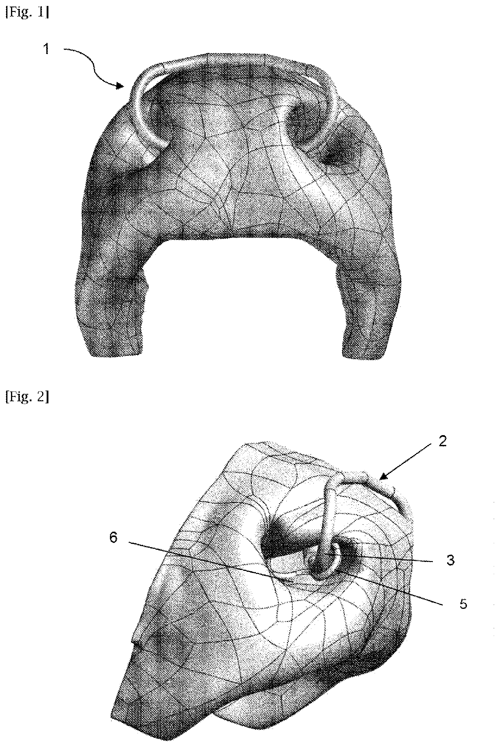 Patent US12342792 Figure 1 – Nose ring for ruminants
