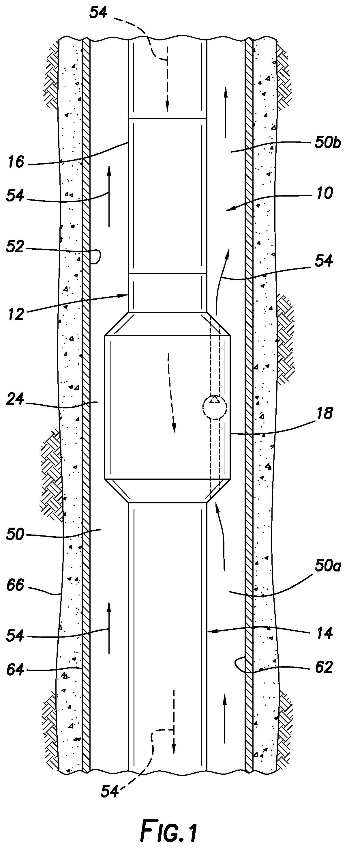 Patent US12345107 Figure 1 – Reduction of equivalent circulating density in well operations