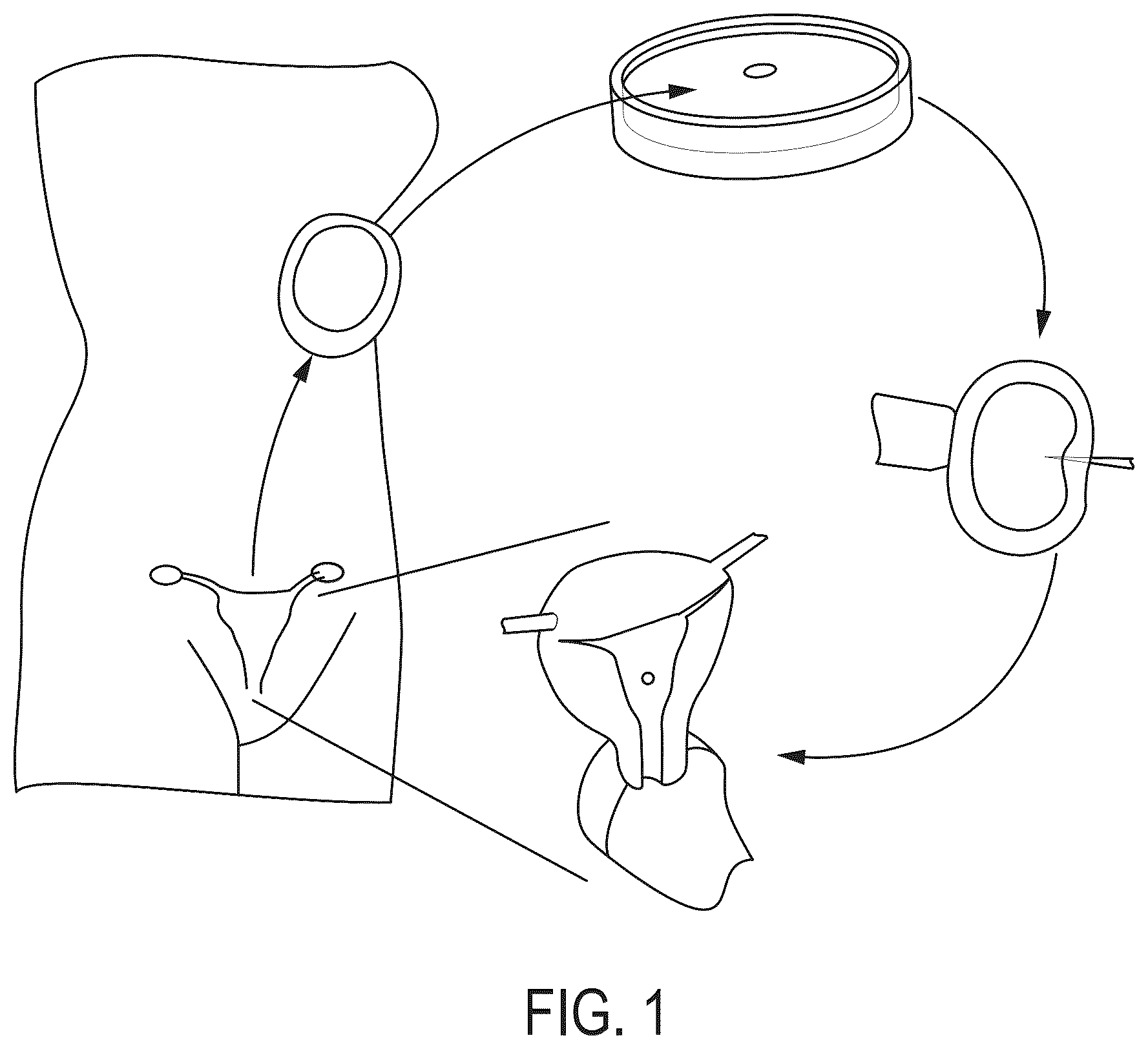 Patent US12345699 — Contactless inspection of reproductive cellular structures using optical measurement of biomechanical properties — Figure 1
