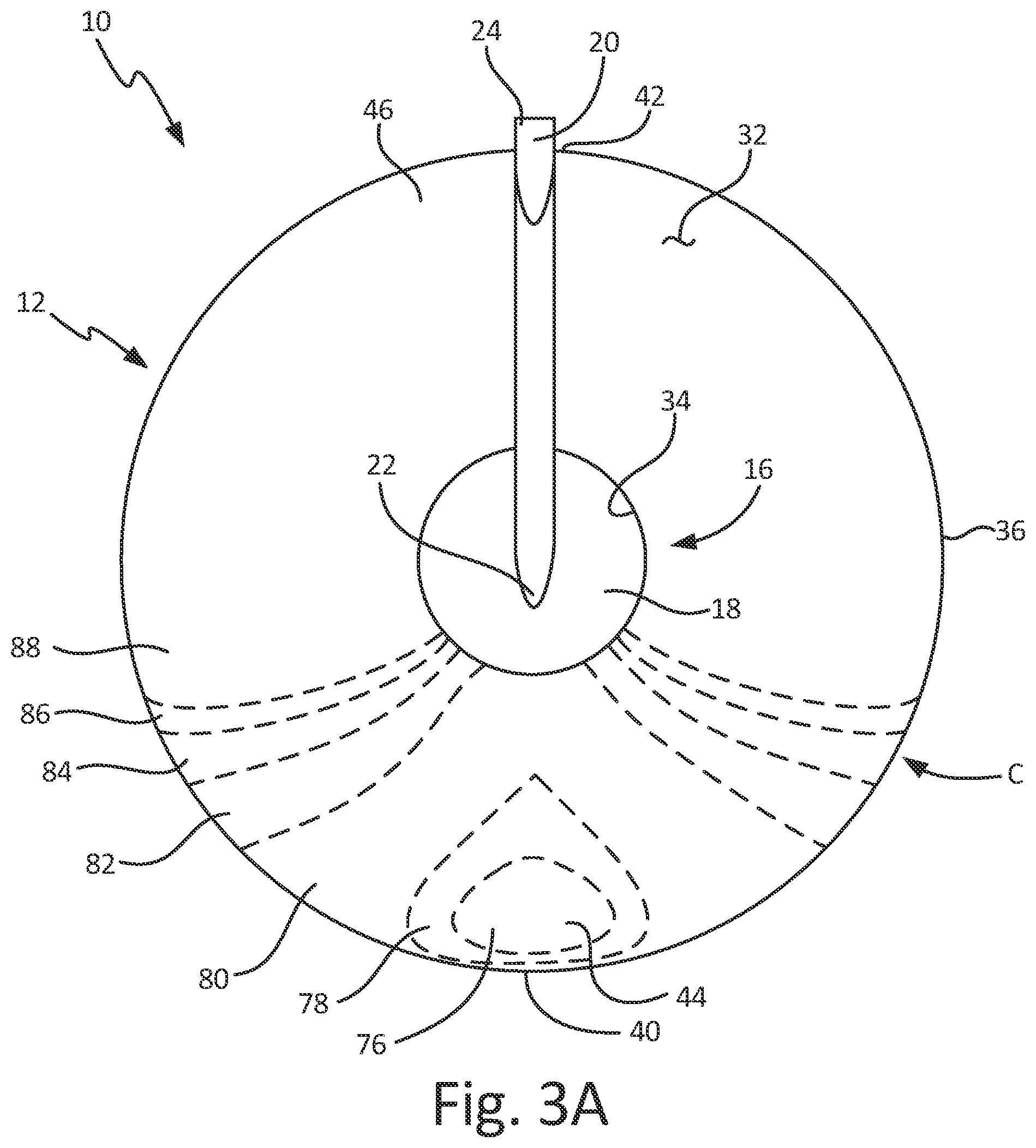 Patent US12345731 Figure 7 – Angle of attack sensor with integral bearing support cage