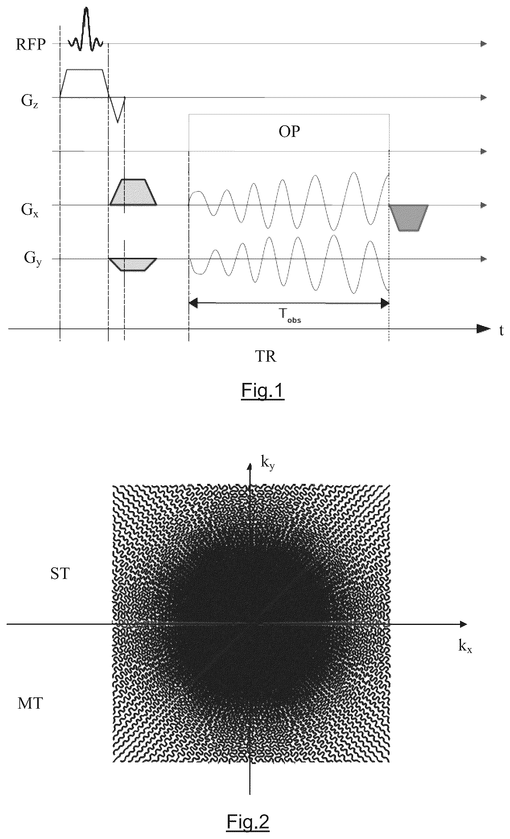 Patent US12345785 — Method and apparatus for performing accelarated magnetic resonance imaging with reduced off-resonance effect — Figure 1