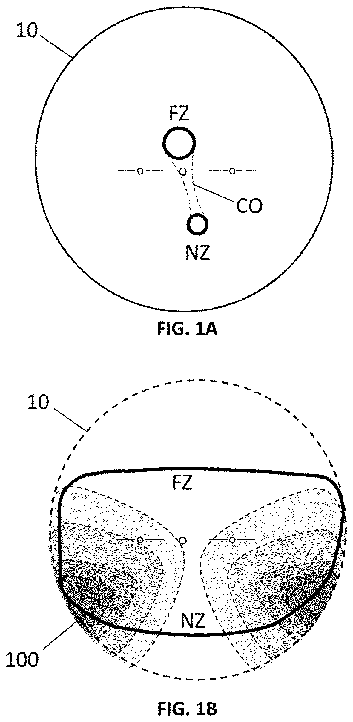 Patent US12345956 Figure 1 – Apparatus and method for projecting a pal lens in front of an eye