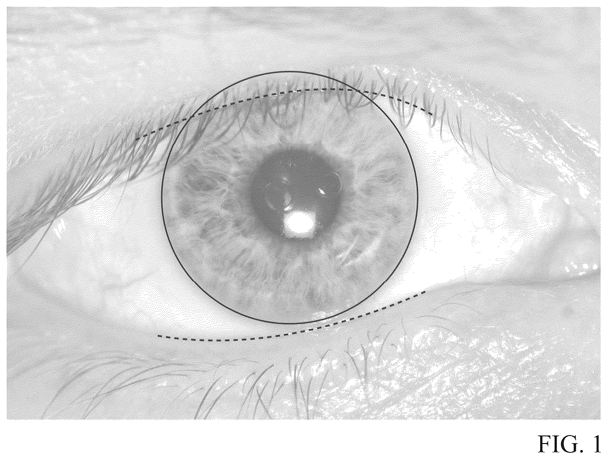 Patent US12345964 — Toric contact lens stabilization design based on thickness gradients orthogonal to eyelid margin — Figure 1