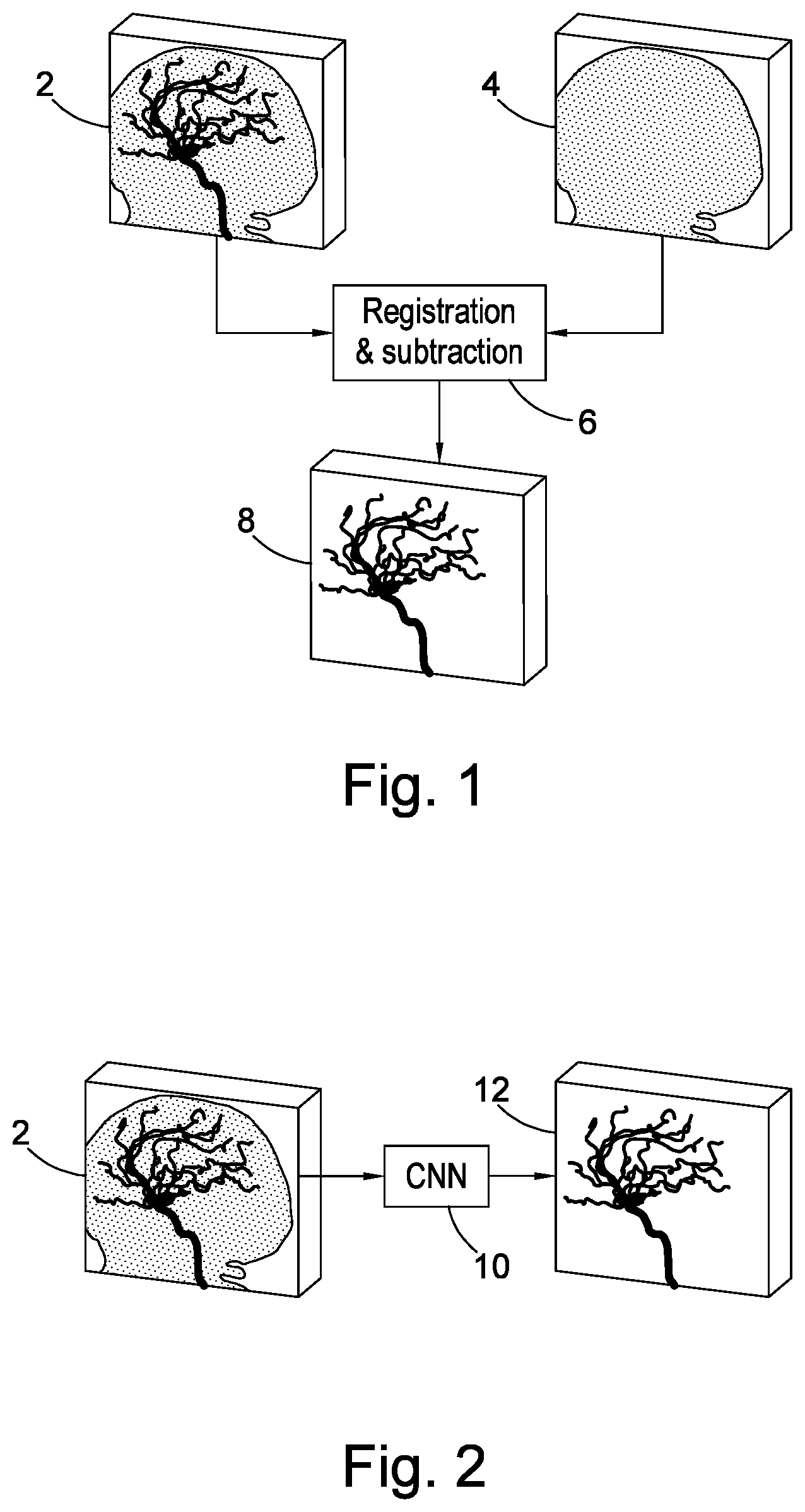 Patent US12347101 Figure 1 – Method and apparatus for producing contrained medical image data