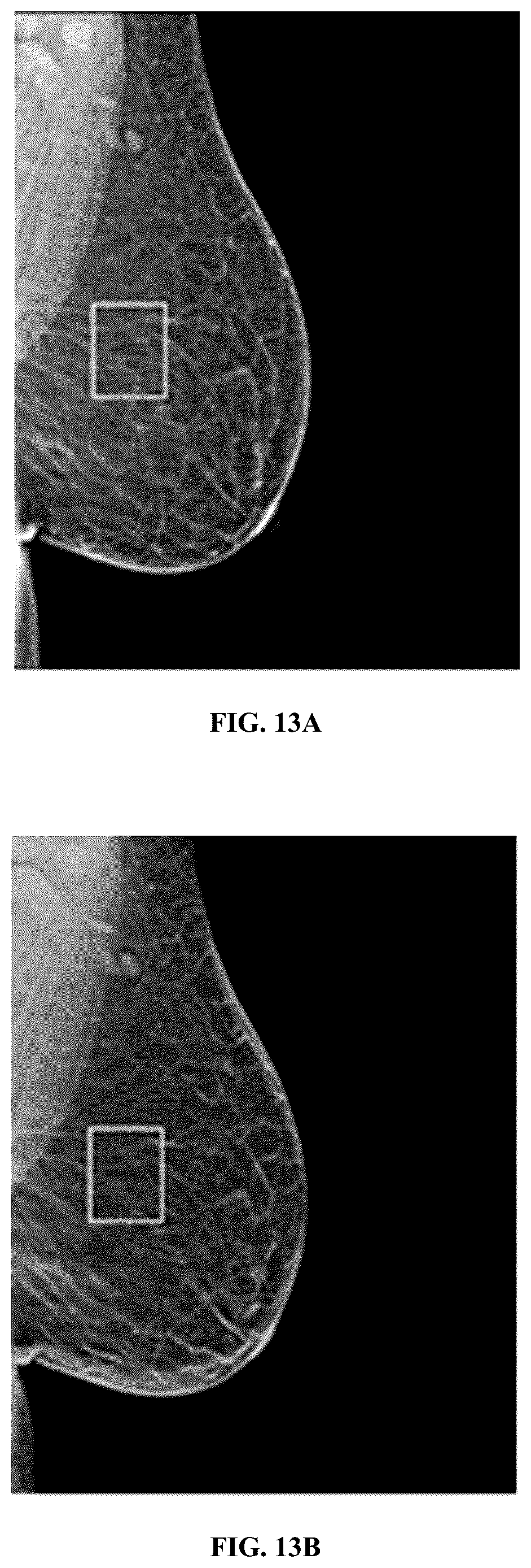 Patent US12347104 Figure 17 – Methods and systems for performing real-time radiology