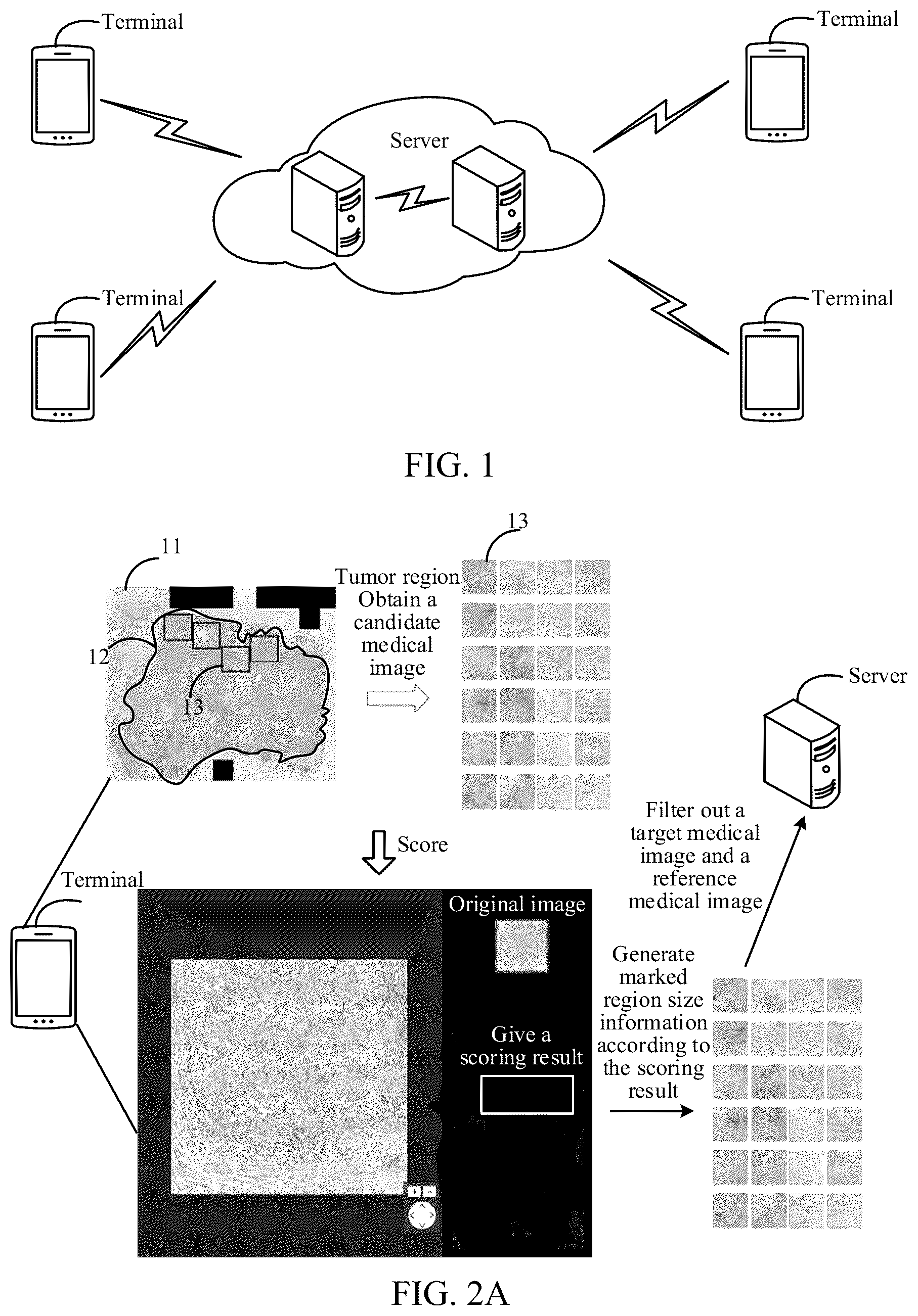 Patent US12347107 — Medical image processing method and apparatus, device, storage medium, and product — Figure 1