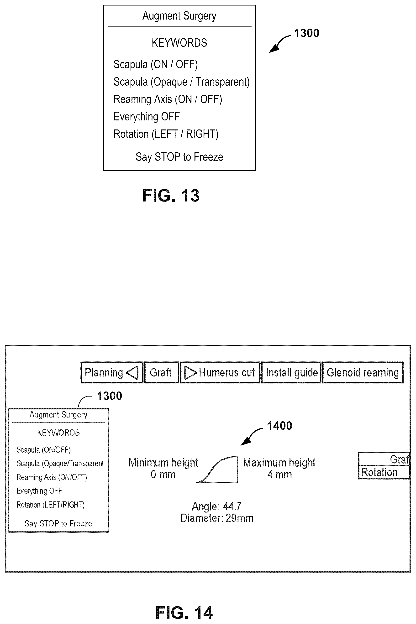 Patent US12347545 Figure 12 – Automated instrument or component assistance using externally controlled light sources in orthopedic surgical procedures
