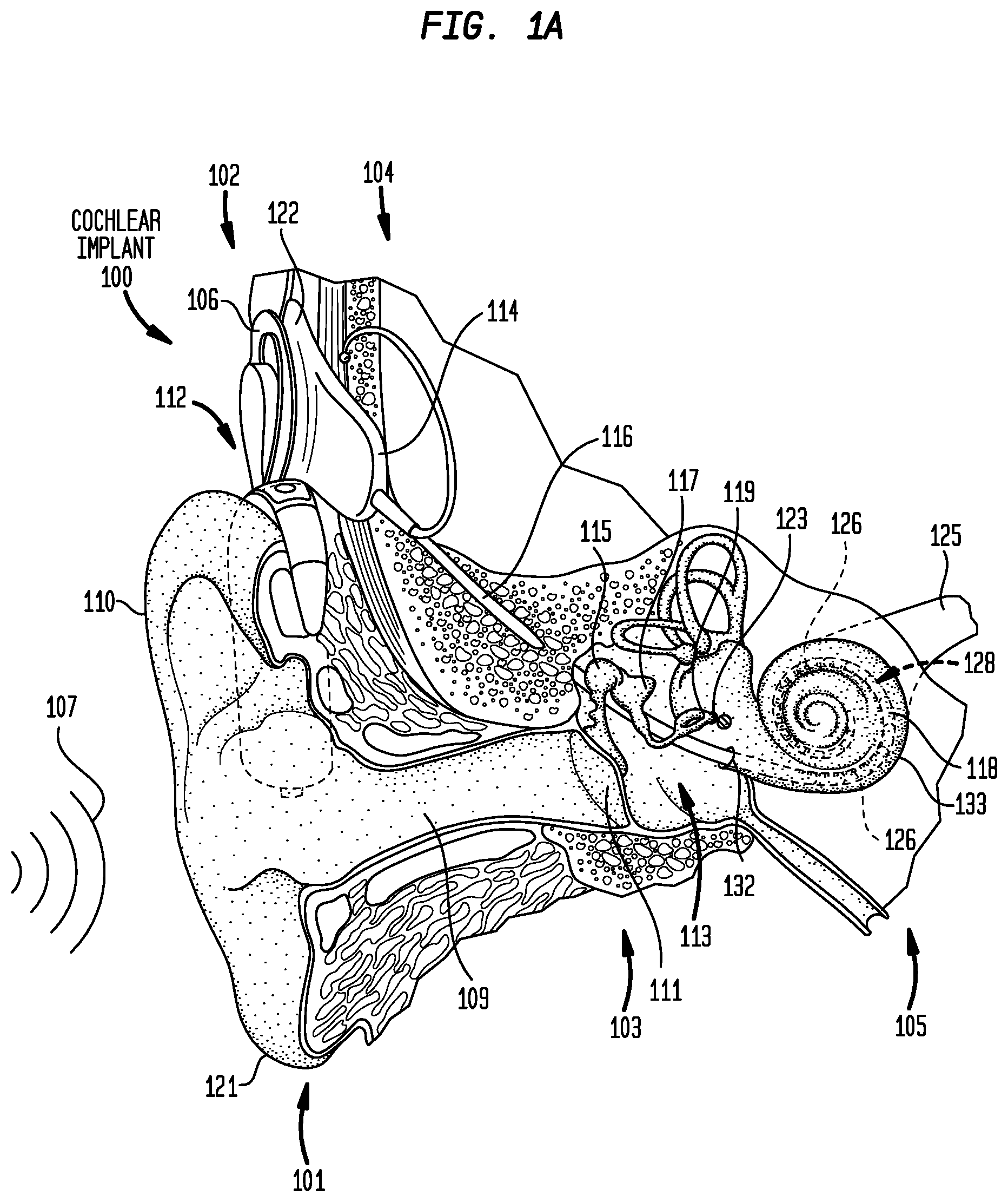 Patent US12347554 — Dynamic virtual hearing modelling — Figure 1