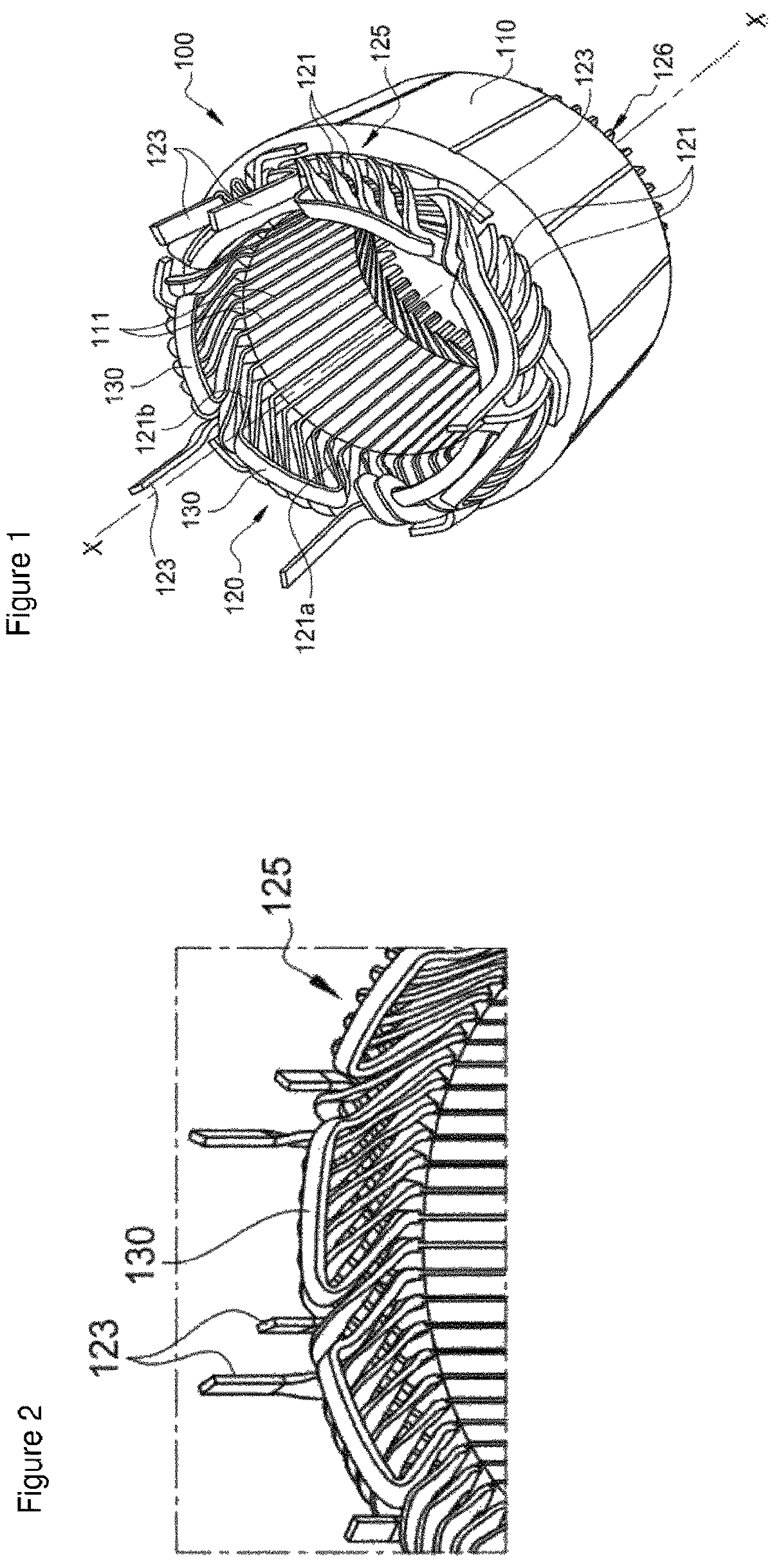 Patent US12348101 — Stator comprising an interconnector — Figure 1