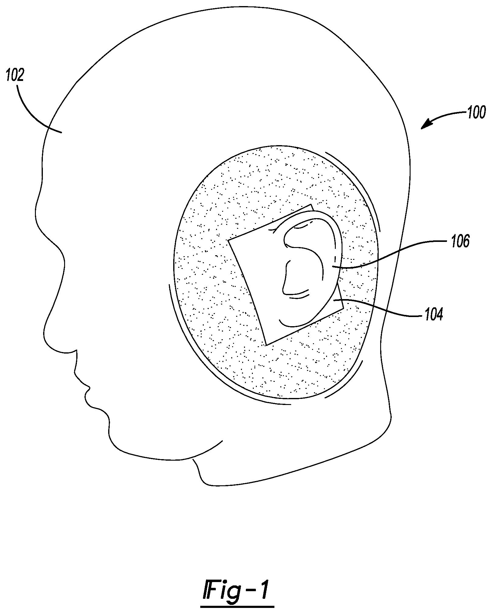 Patent US12348919 — Insert for headphone measurements on a head shaped fixture — Figure 1
