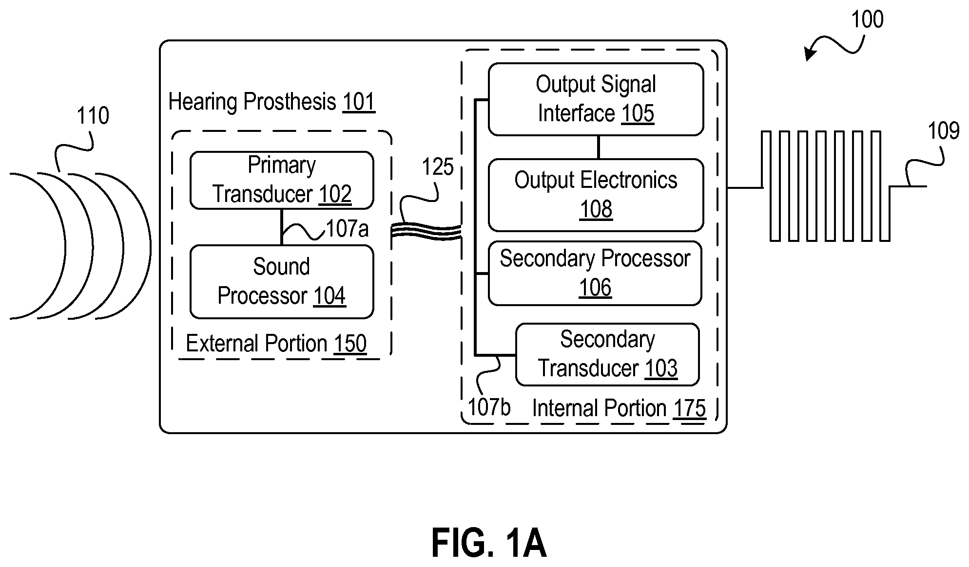 Patent US12348934 — Sound awareness hearing prosthesis — Figure 1