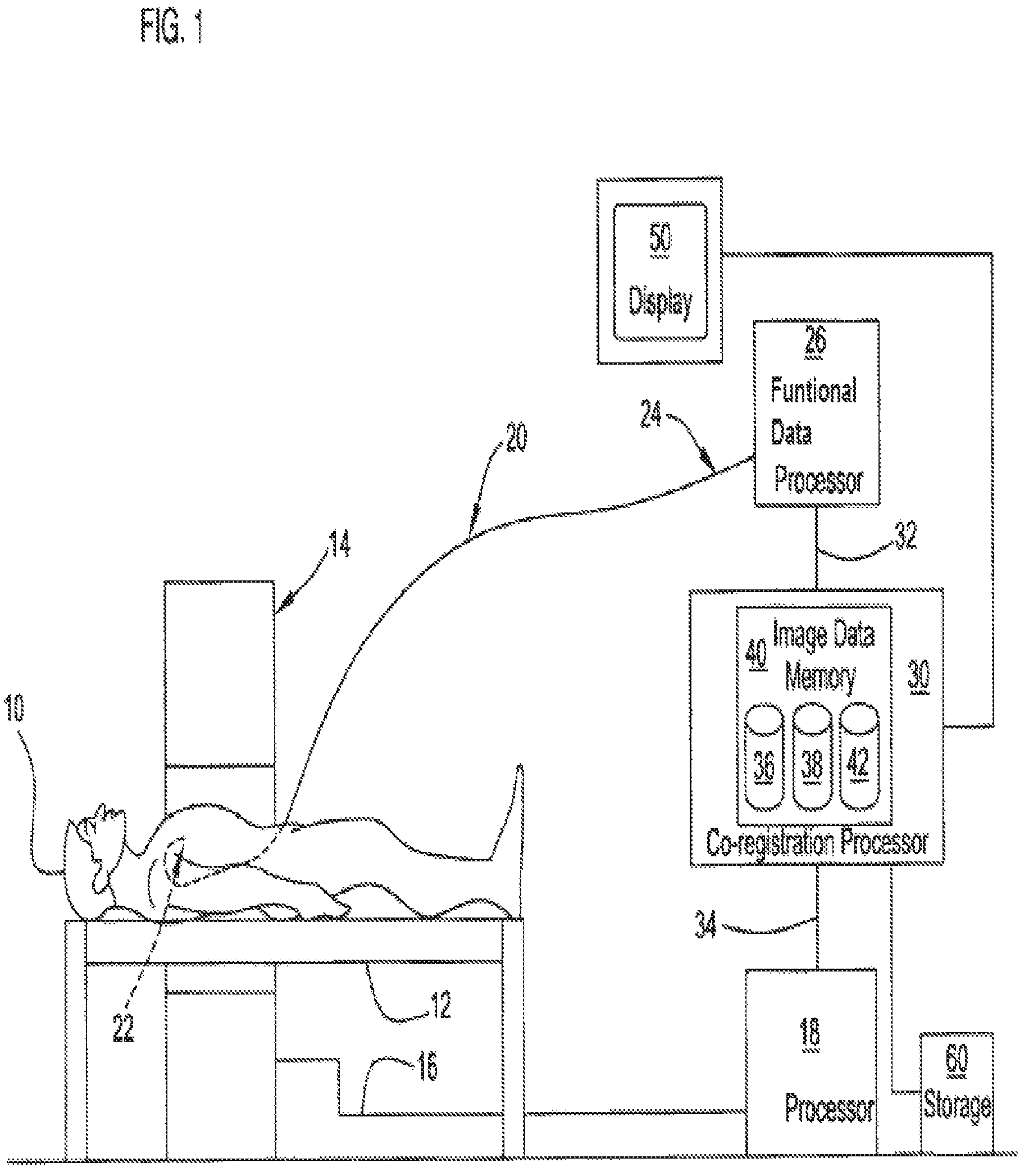 Patent US12350018 — Systems and methods for diagnosing coronary microvascular disease — Figure 1