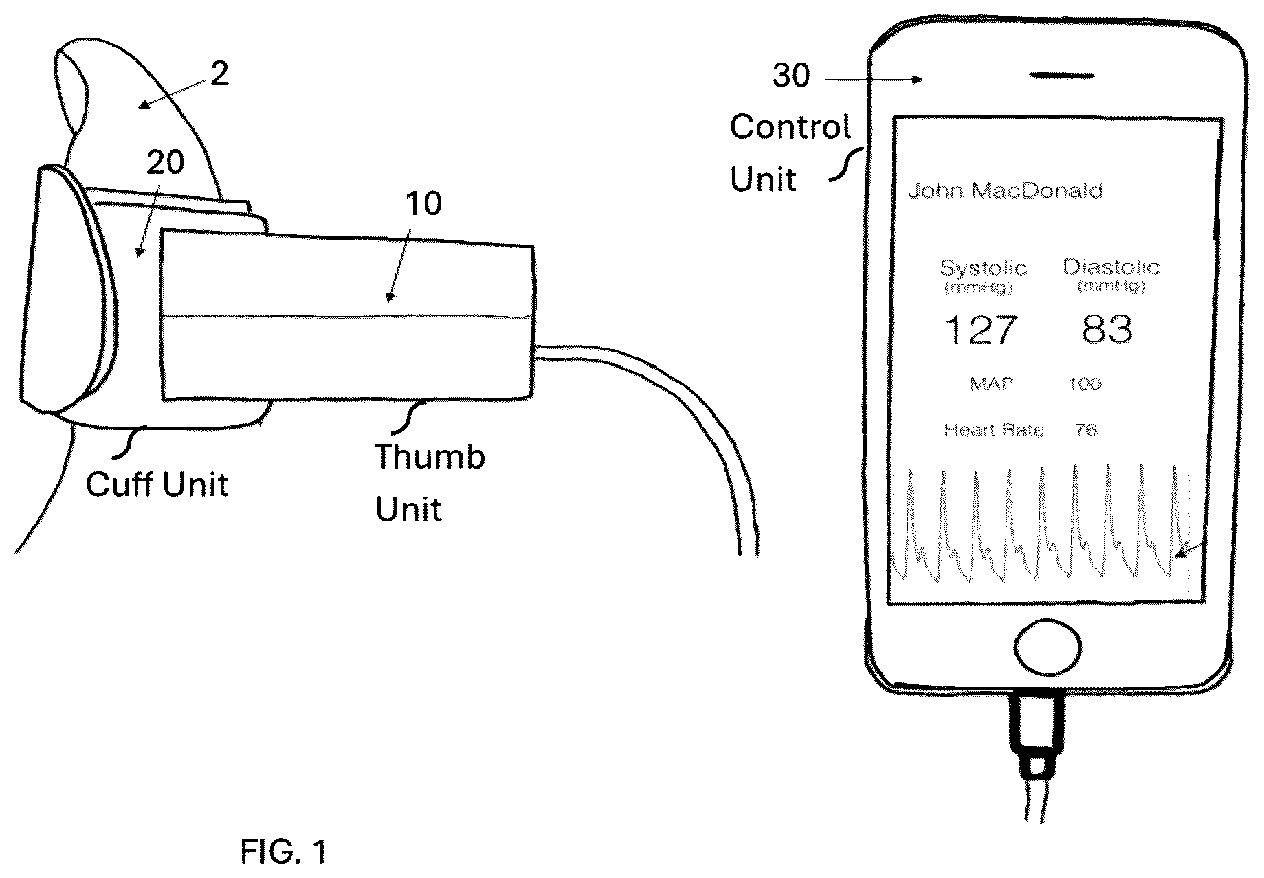 Patent US12350025 Figure 1 – Optical-based oscillometry blood pressure measurement device