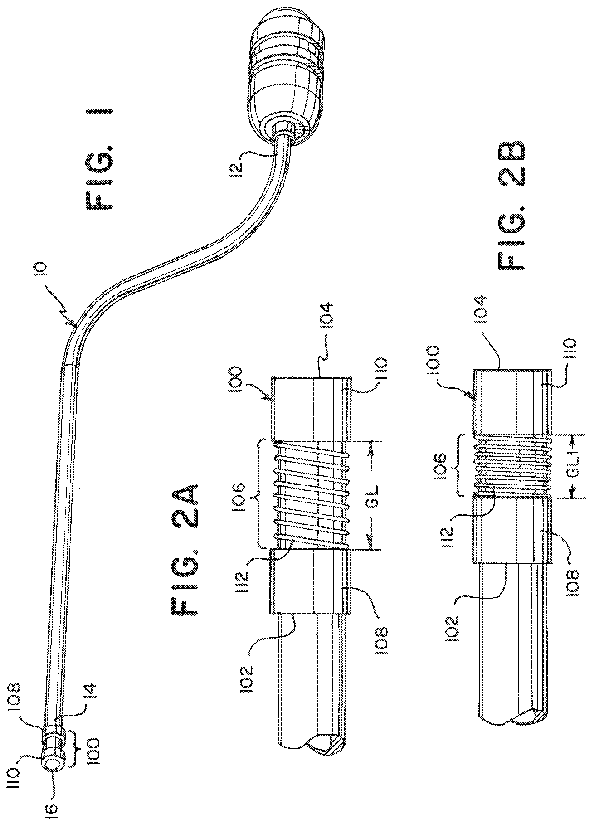 Patent US12350033 — Device and method to detect and remove blood clots for treatment of ischemic stroke using force and electromagnetic sensing — Figure 1