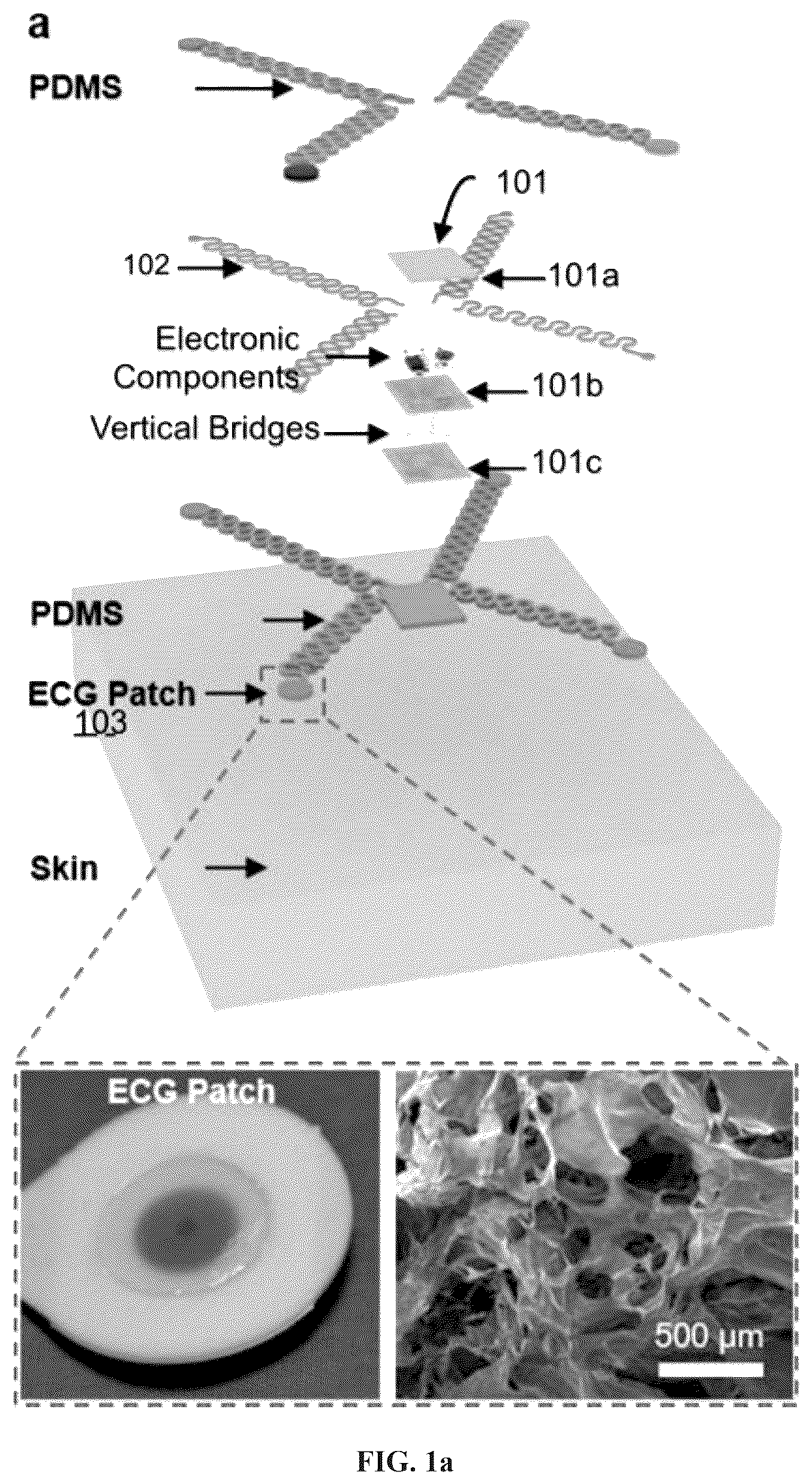 Patent US12350054 — Stretchable and wearable wireless 3-leads ECG monitoring apparatus — Figure 1