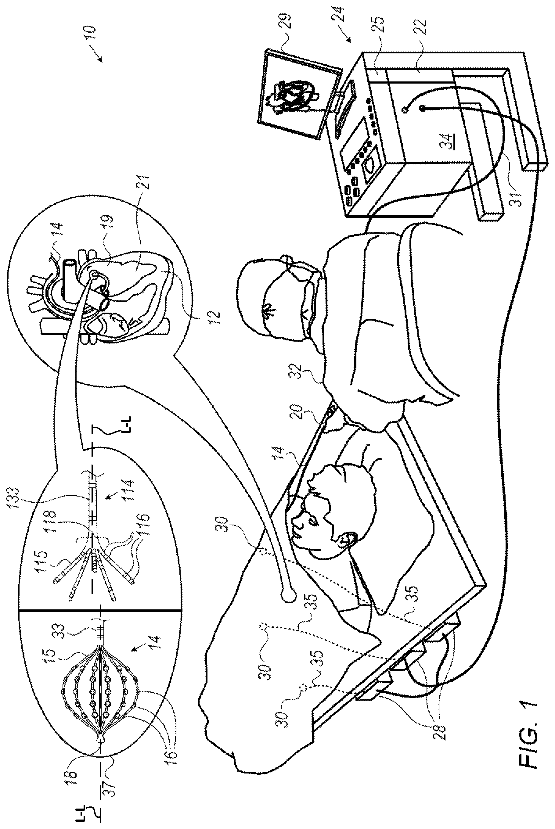 Patent US12350057 — Analyzing multi-electrode catheter signals to determine electrophysiological (EP) wave propagation vector — Figure 1