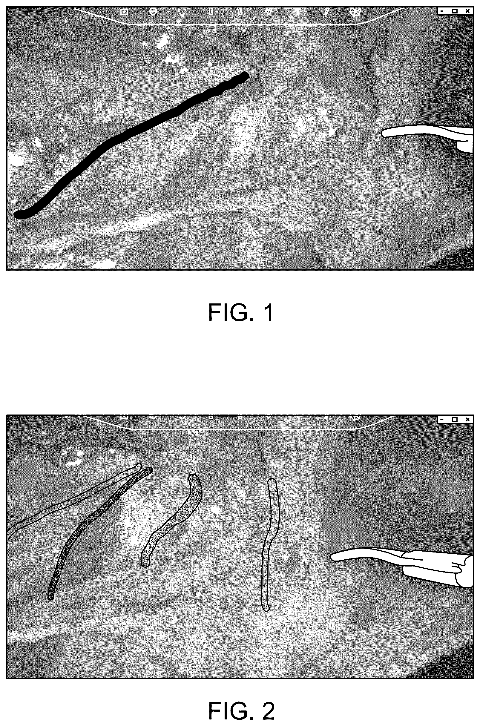 Patent US12350112 — Creating surgical annotations using anatomy identification — Figure 1