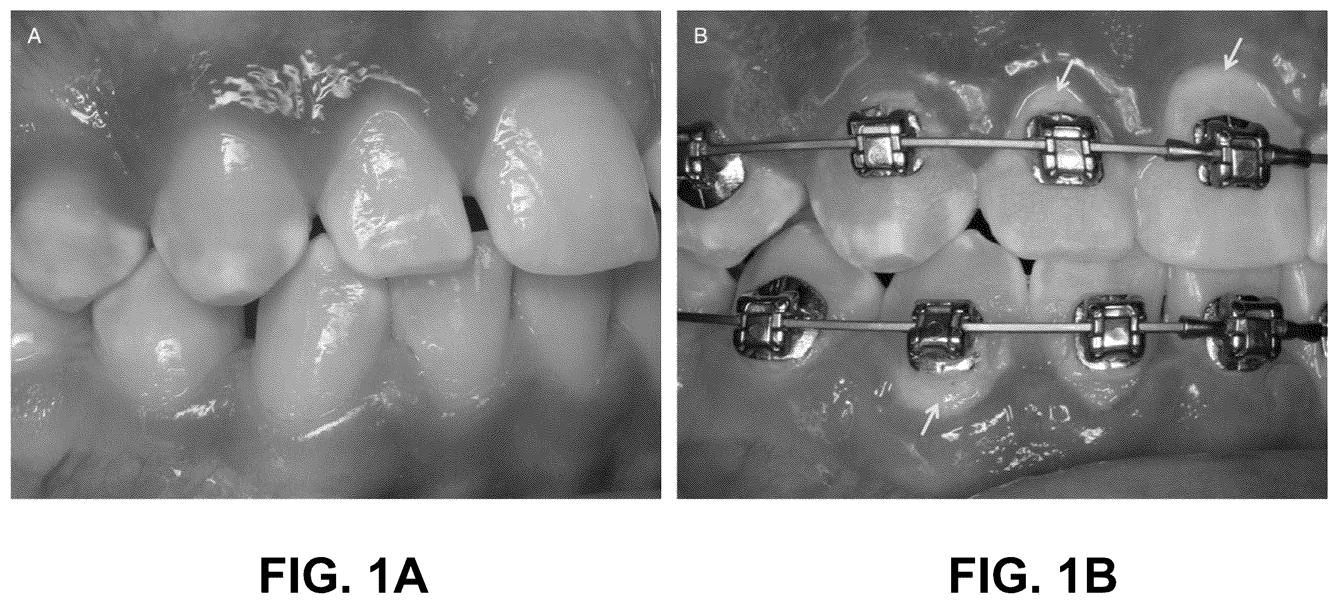Patent US12350117 — Oral hygiene devices configured for use with orthodontics — Figure 1