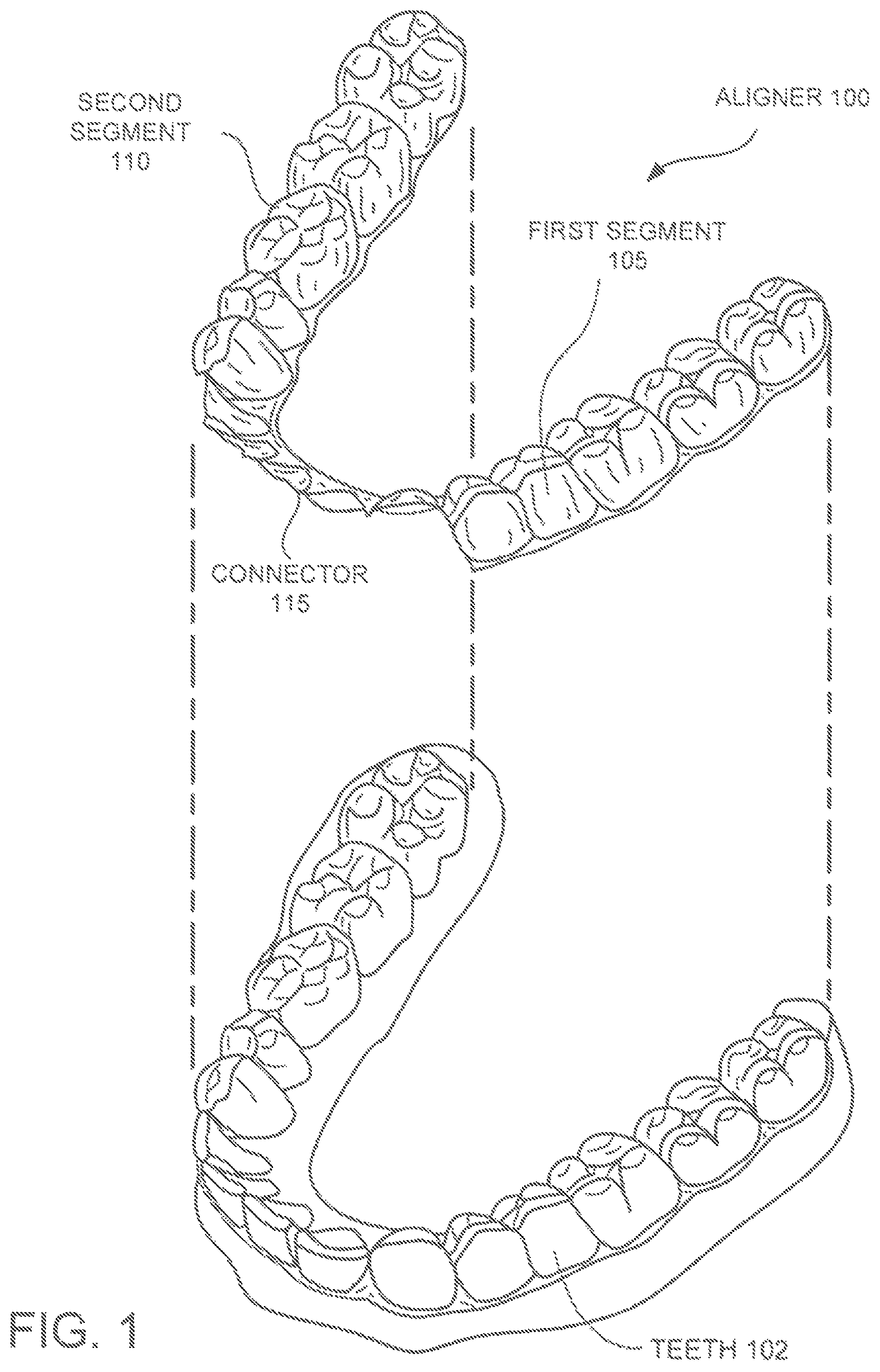 Patent US12350121 — Orthodontic aligner with isolated segments — Figure 1