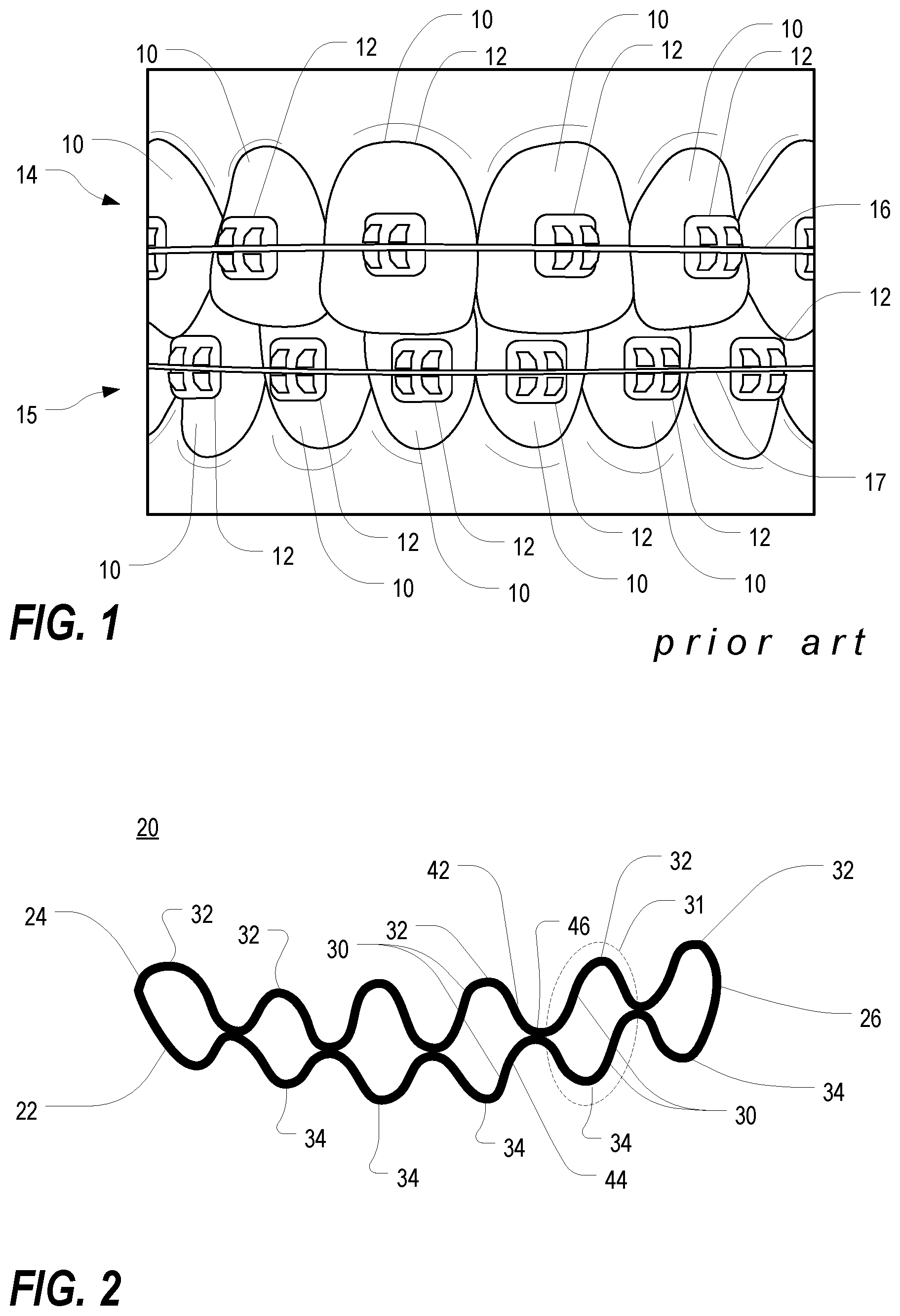 Patent US12350122 — Orthodontic device for lateral tooth movement — Figure 1