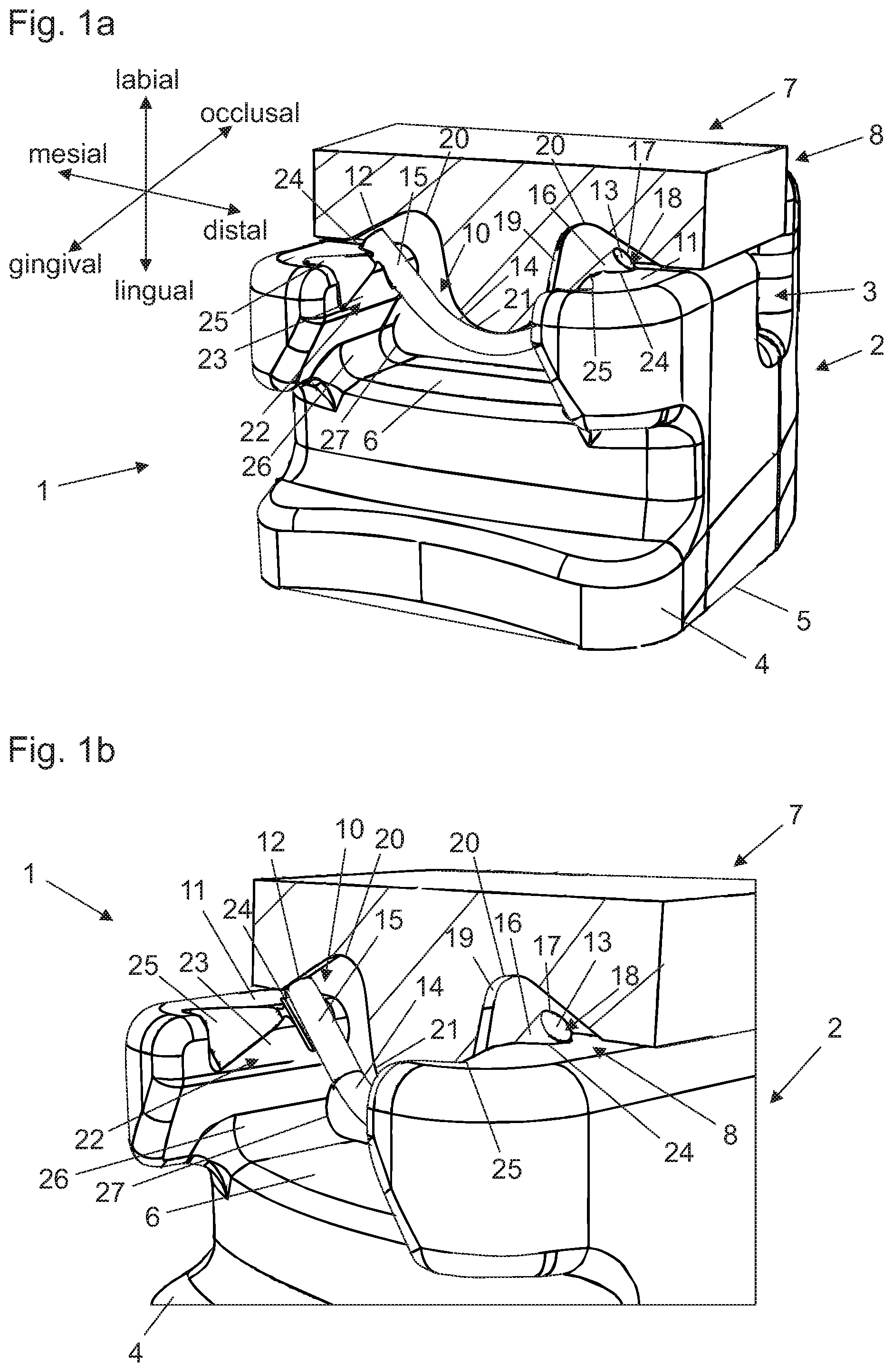 Patent US12350123 — Self-ligating orthodontic bracket — Figure 1