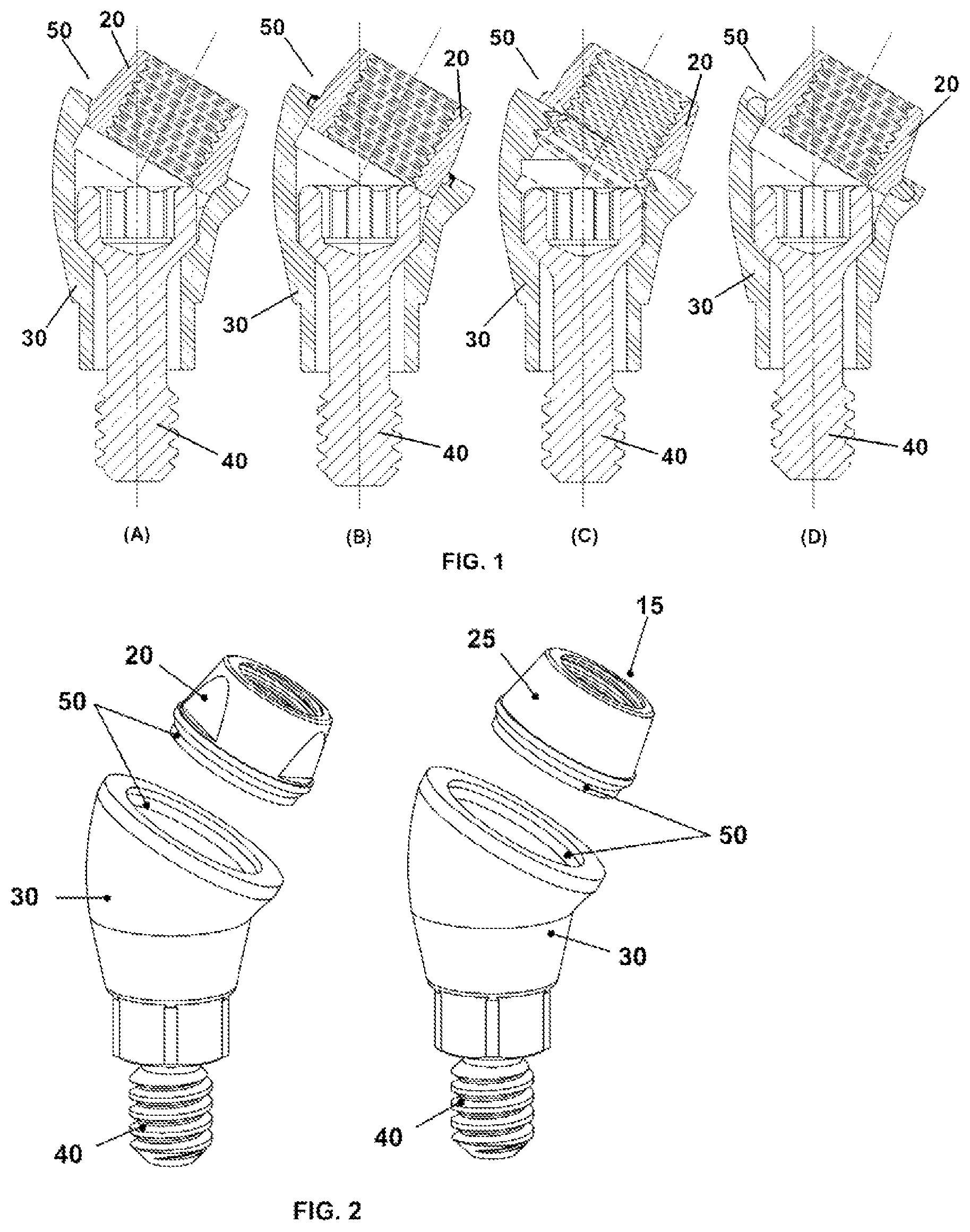 Patent US12350124 Figure 1 – Transepithelial abutment