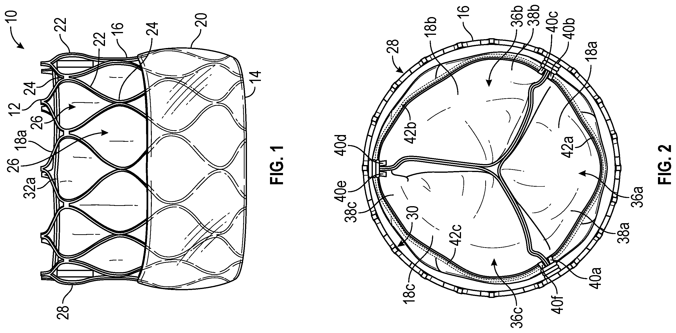 Patent US12350139 — Systems and methods for holding prosthetic implants — Figure 1