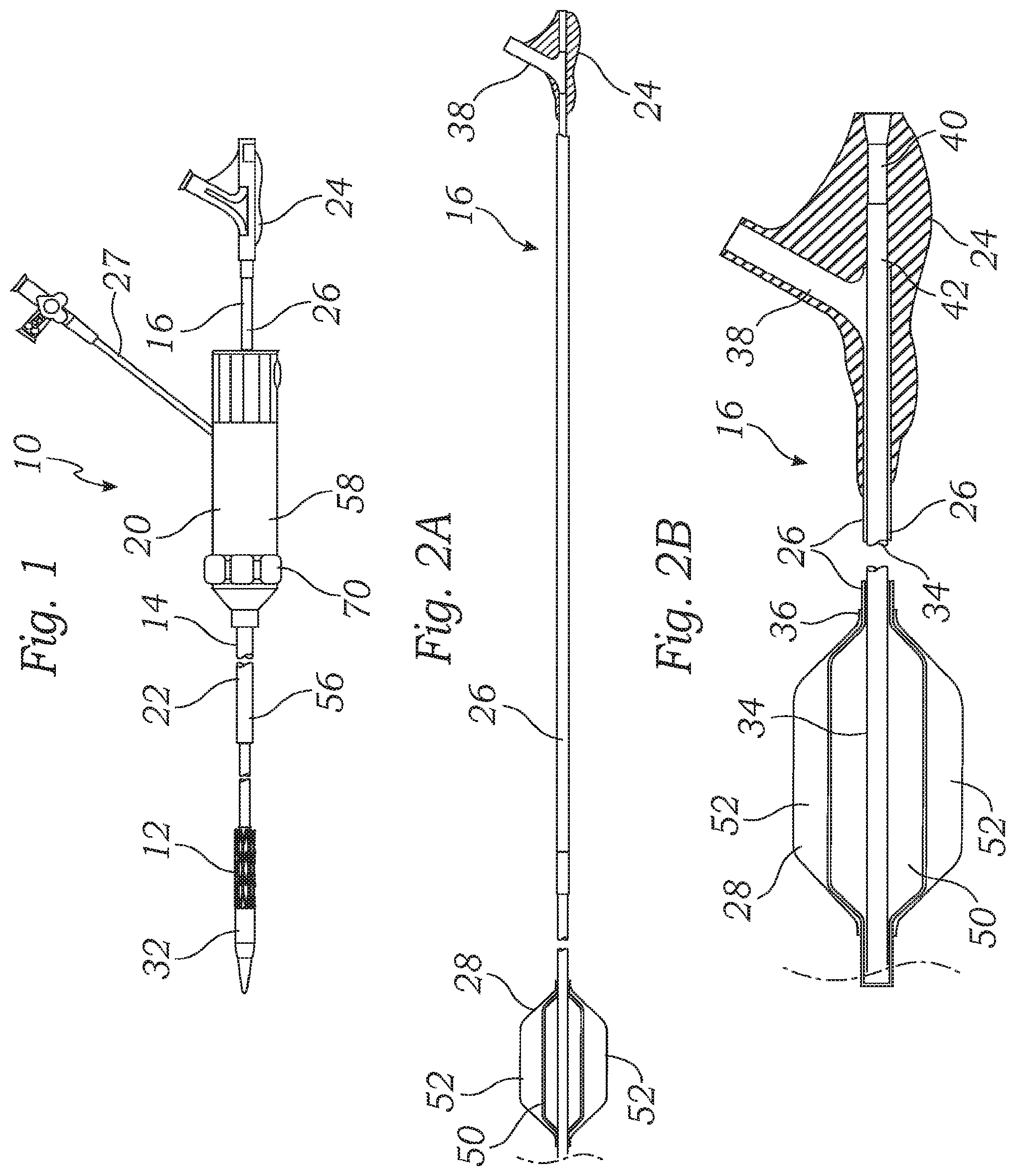 Patent US12350150 — Stability device for use with percutaneous delivery systems — Figure 1