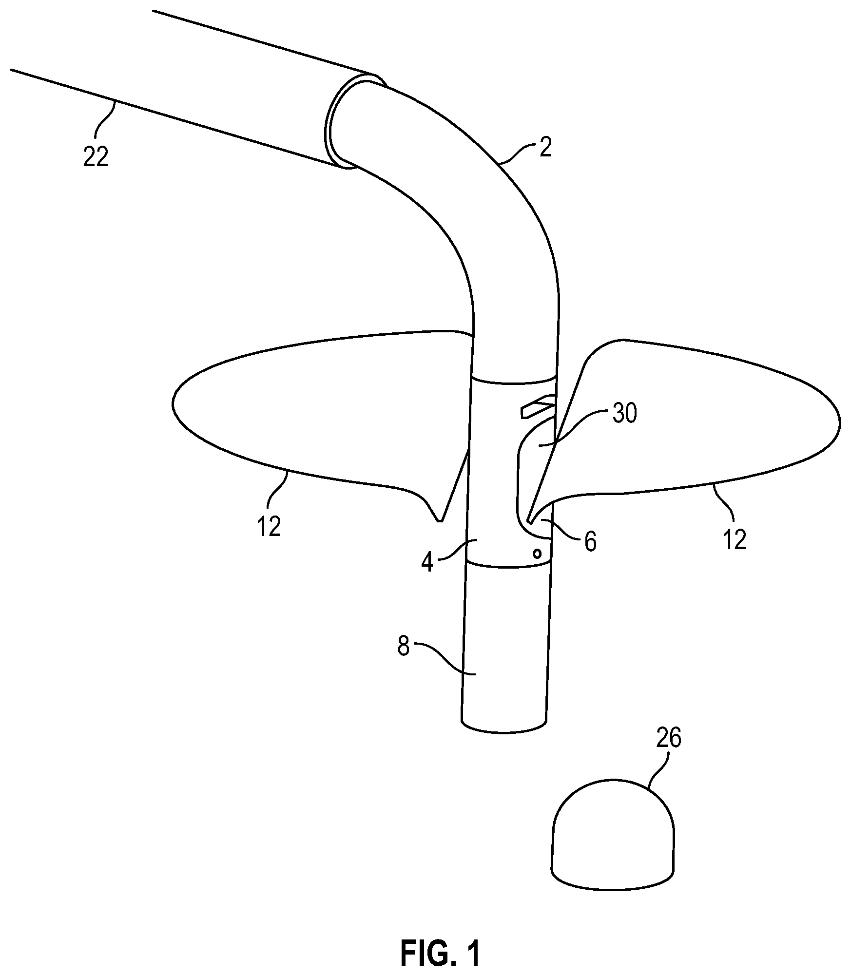 Patent US12350157 — Device for heart repair — Figure 1