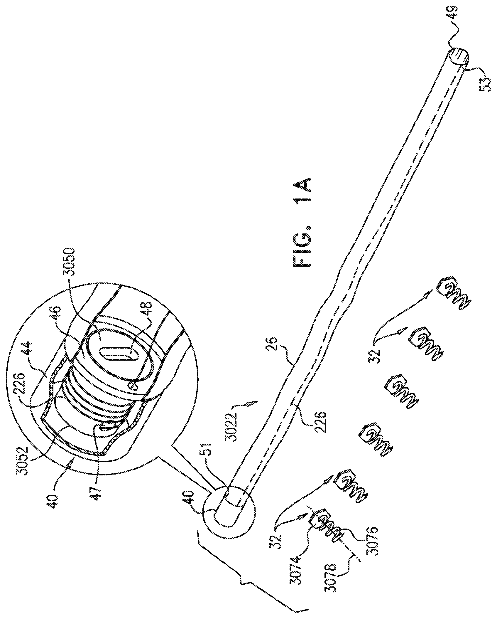 Patent US12350158 — Annuloplasty ring delivery catheters — Figure 1