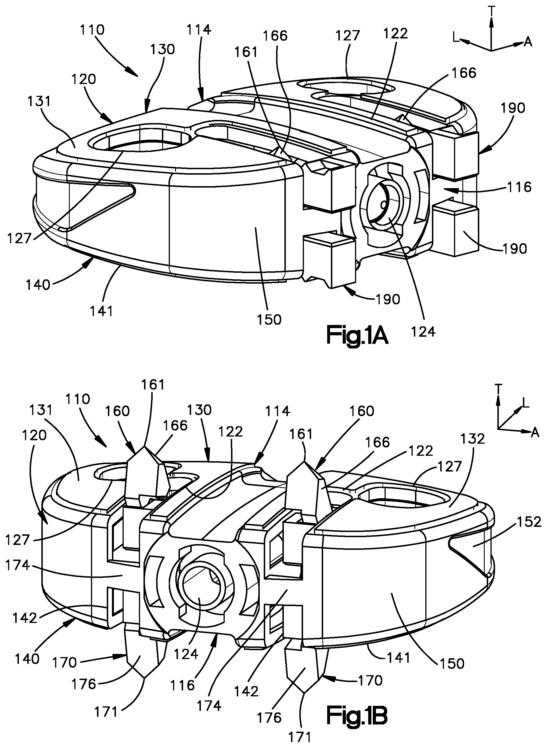 Patent US12350167 Figure 1 – Intervertebral cages with deployable anchors