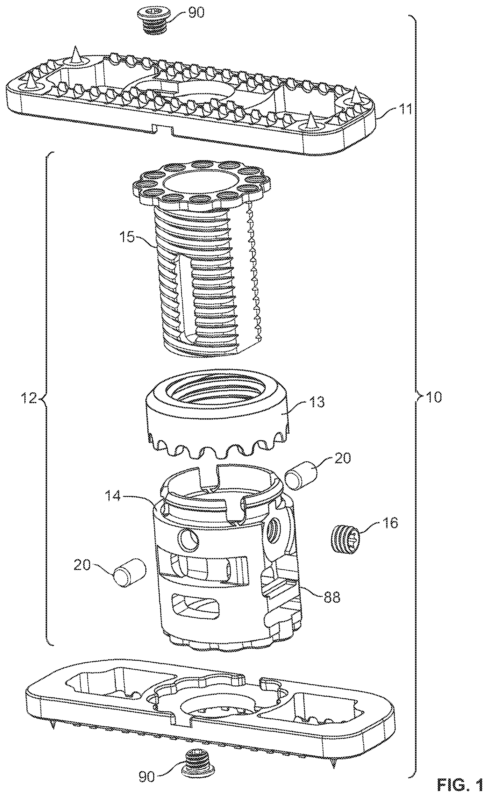 Patent US12350169 — Vertebral body replacement — Figure 1