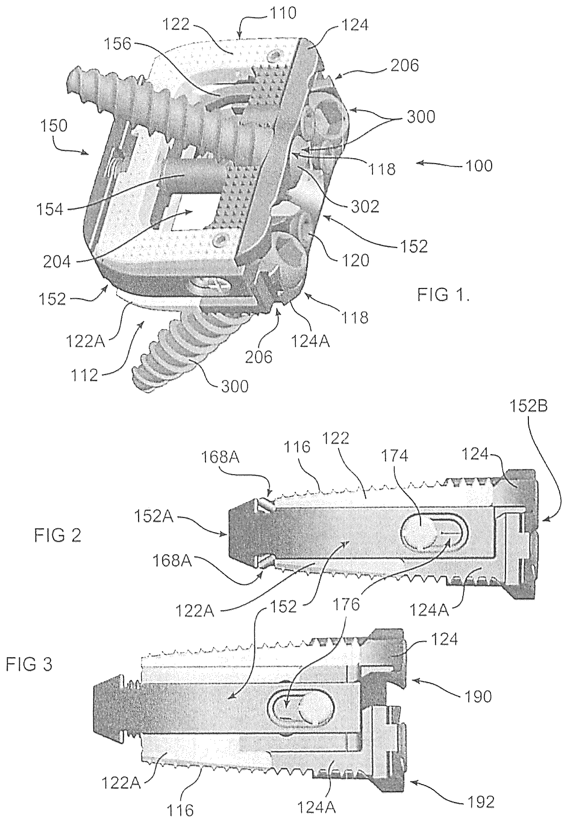 Patent US12350170 — Expandable intervertebral implant — Figure 1
