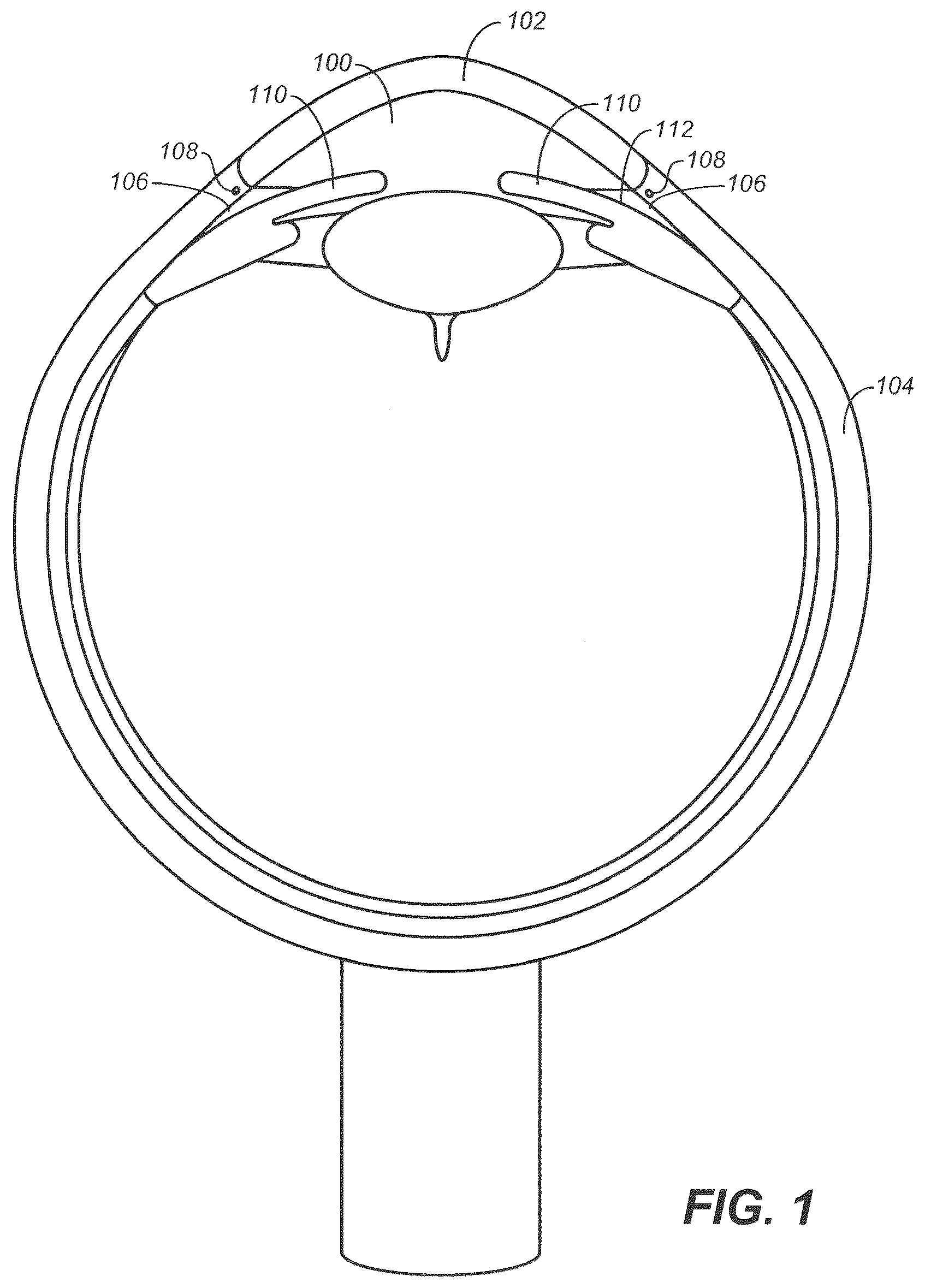 Patent US12350192 — Ocular delivery systems and methods — Figure 1