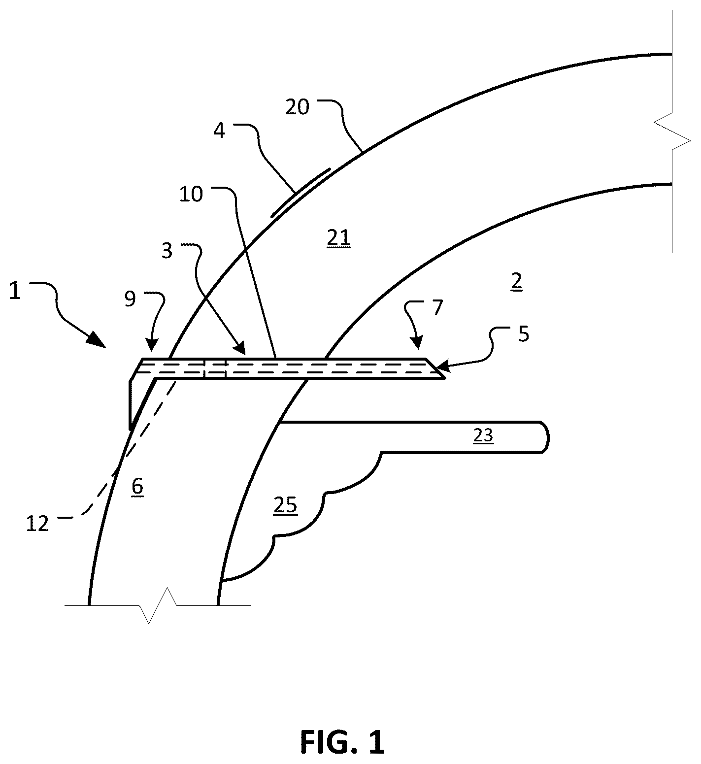 Patent US12350193 — Dry eye treatment devices and methods — Figure 1