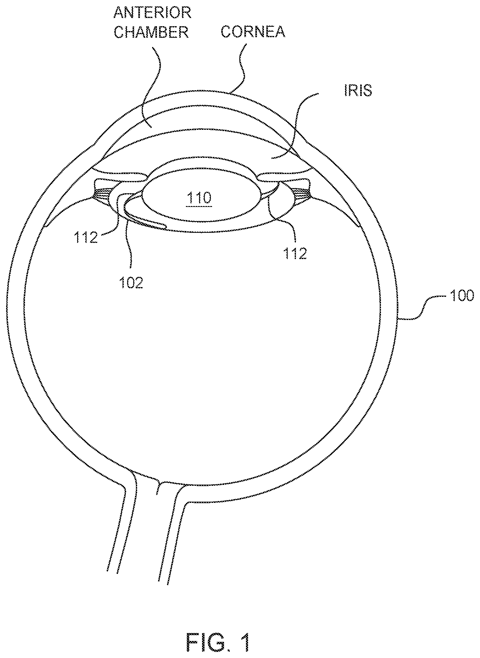 Patent US12350195 — Methods and apparatus for performing ocular biometry — Figure 1