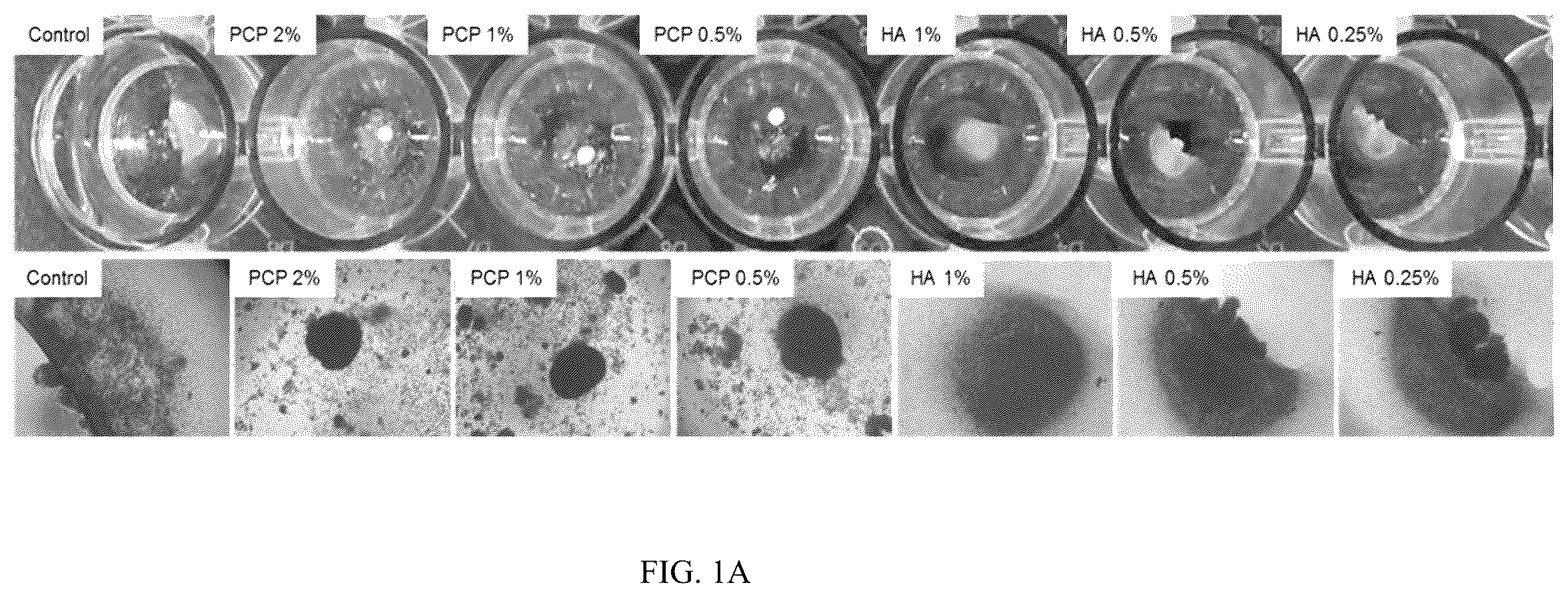 Patent US12350295 — Complex for promoting cartilage differentiation comprising cartilage cell-free crush and stem cell and use thereof — Figure 1
