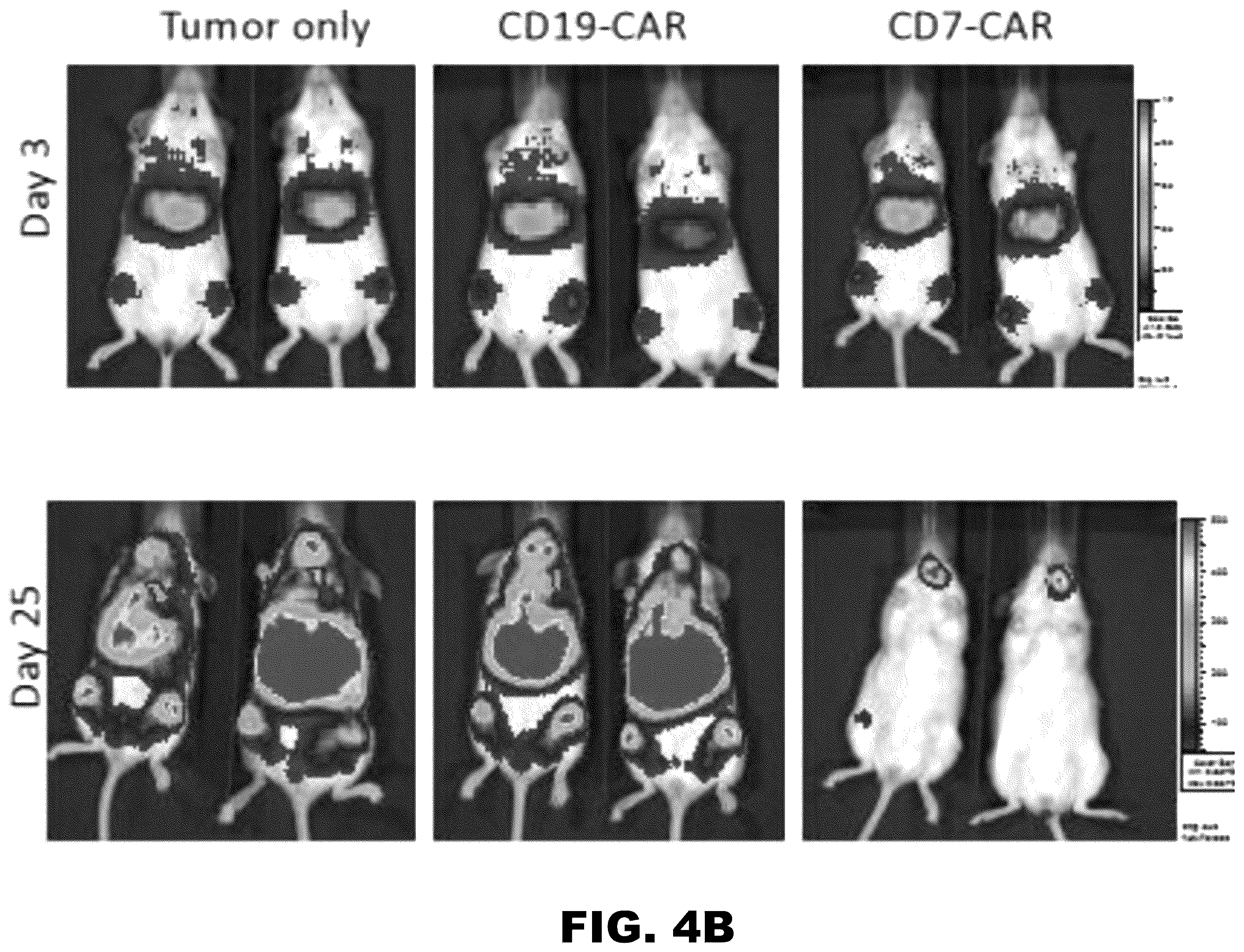 Patent US12350349 Figure 5 – Gene editing of CAR-T cells for the treatment of T cell malignancies with chimeric antigen receptors